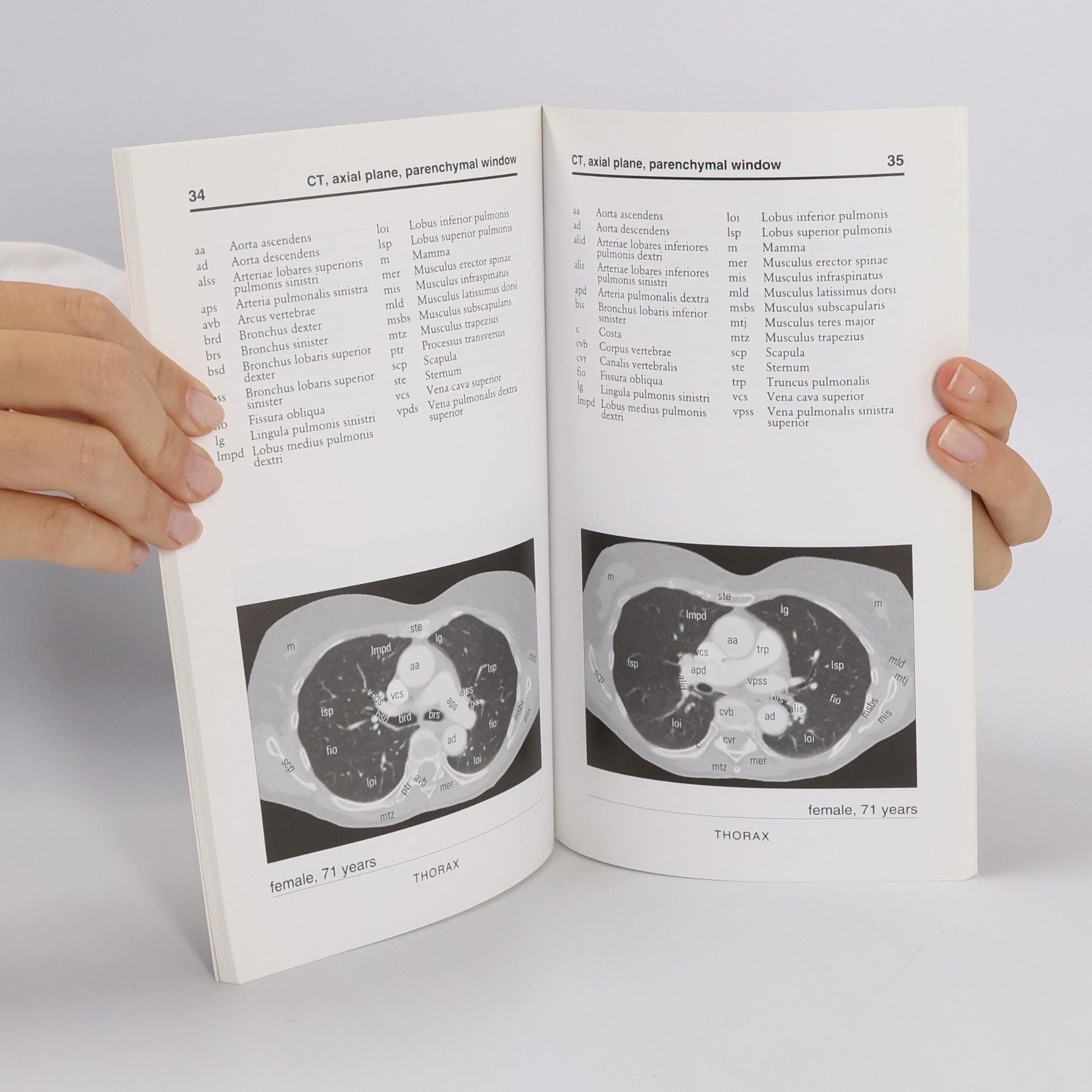 Jiří Neuwirth Anatomia Radiologica Thoracica Basalis