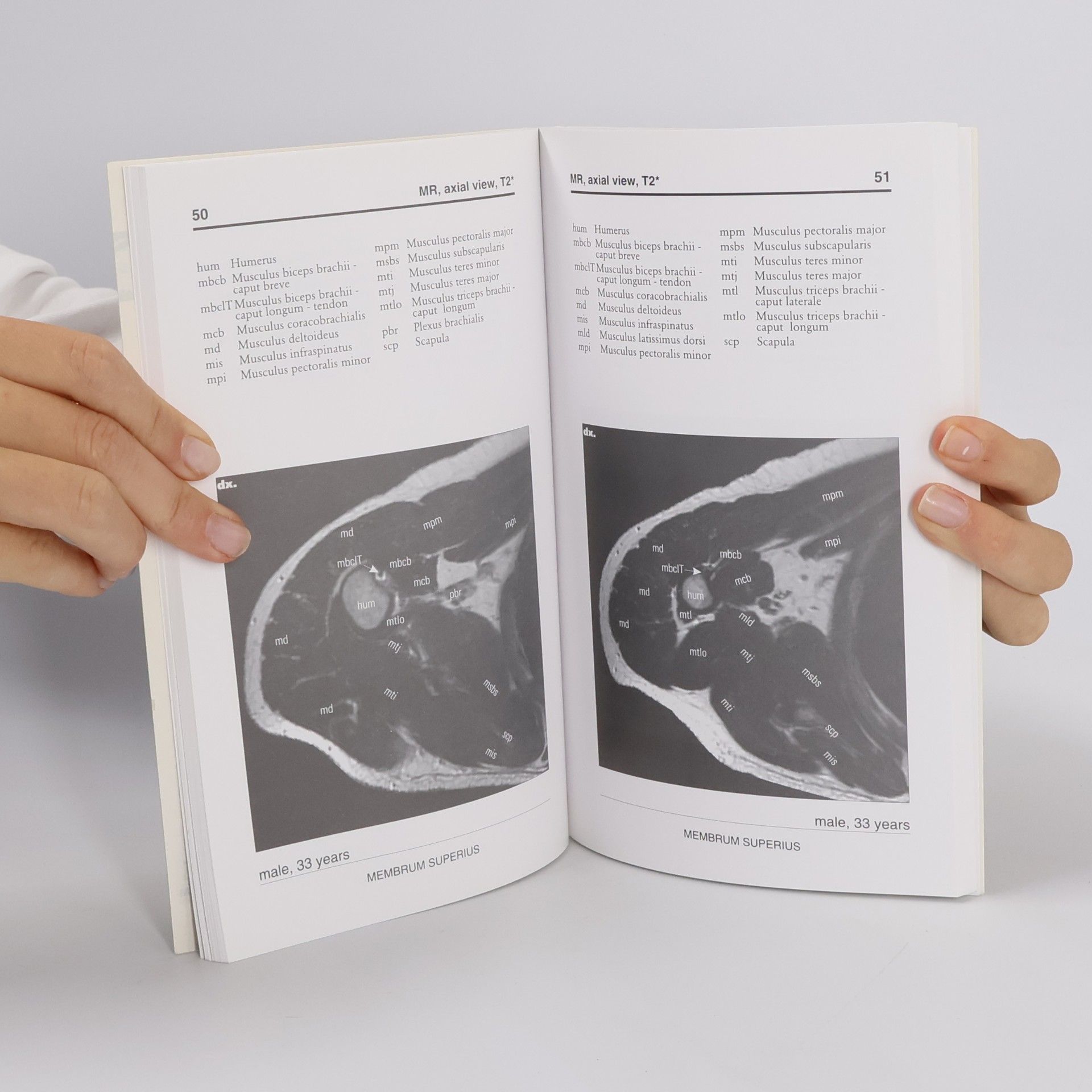 Jiří Neuwirth Anatomia Radiologica Musculoskeletatis Basalis