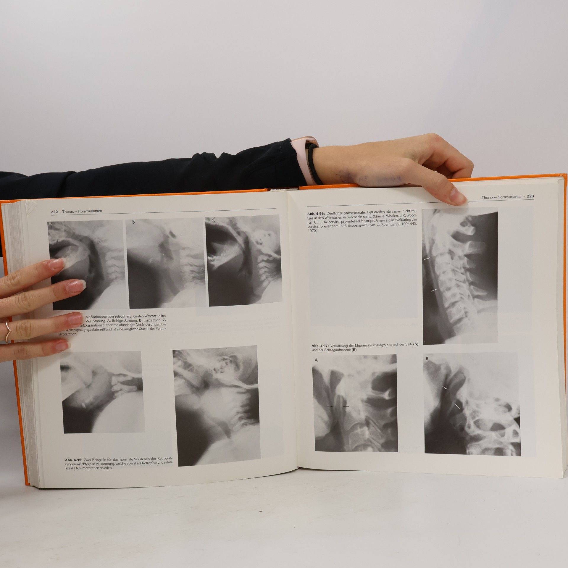 Theodore E. Keats Notfallradiologie