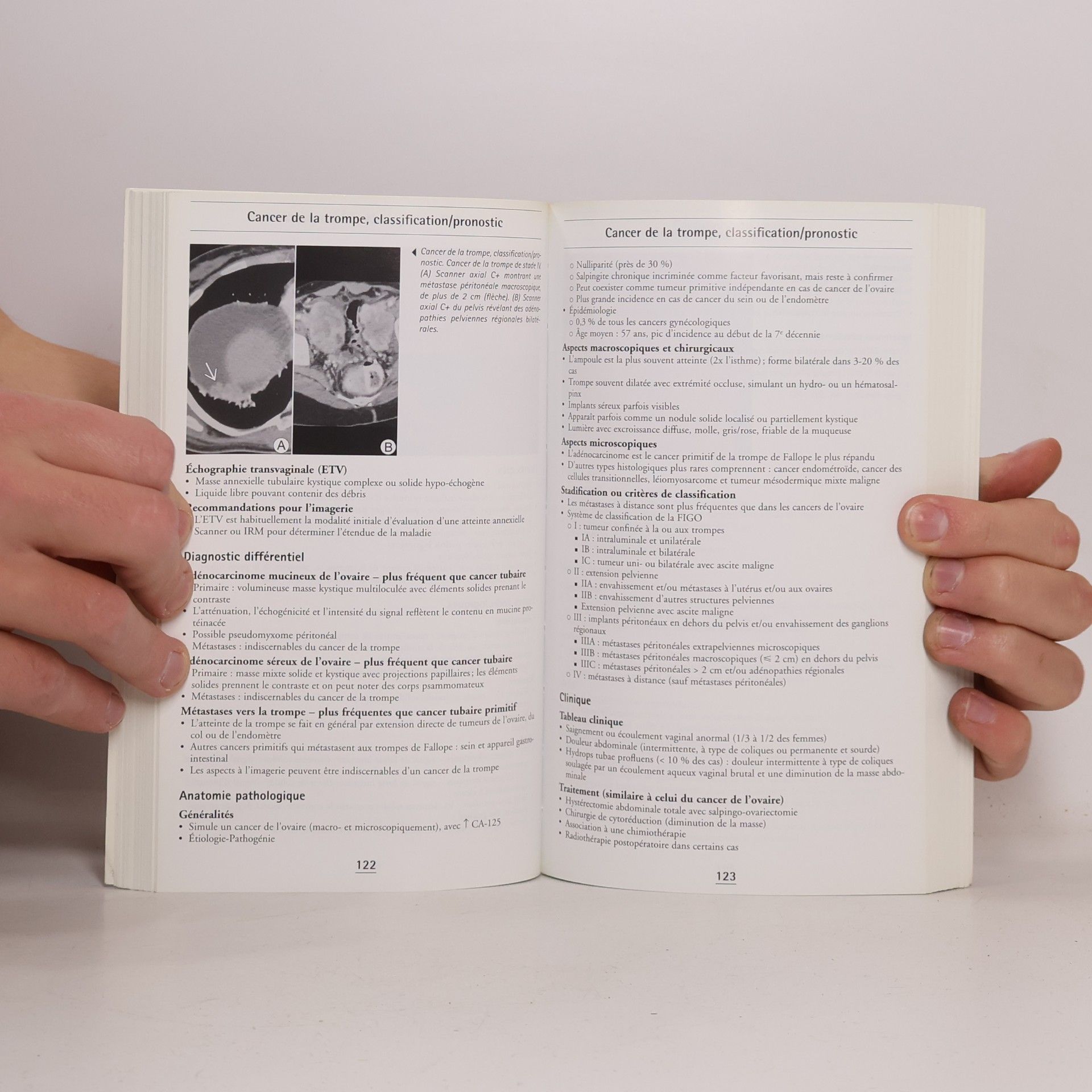 Caroline Reinhold RADIOLOGIE DE POCHE - GYNECOLOGIE. LES 100 PRINCIPAUX DIAGNOSTICS