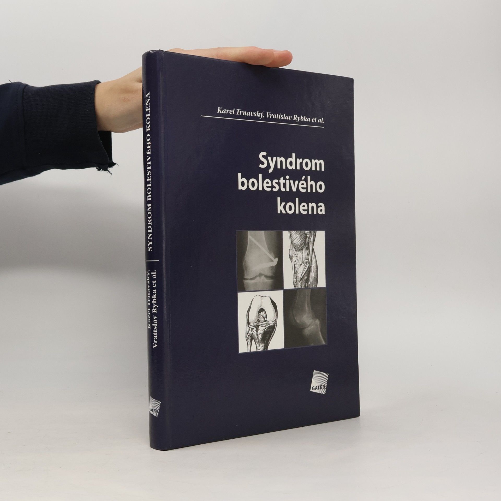 Syndrom bolestivého kolena