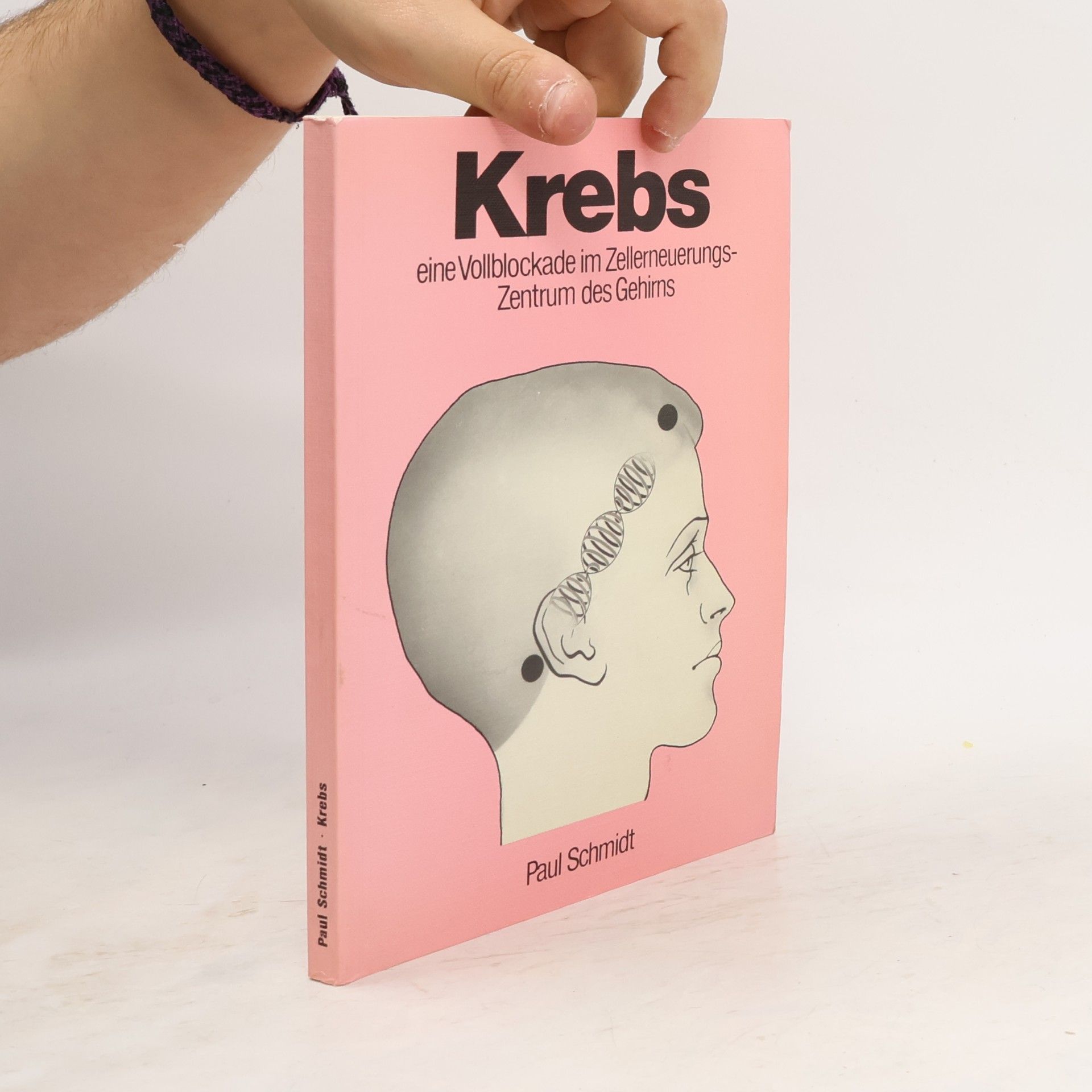 Krebs. Eine Vollblockade im Zellerneuerungszentrum des Gehirns