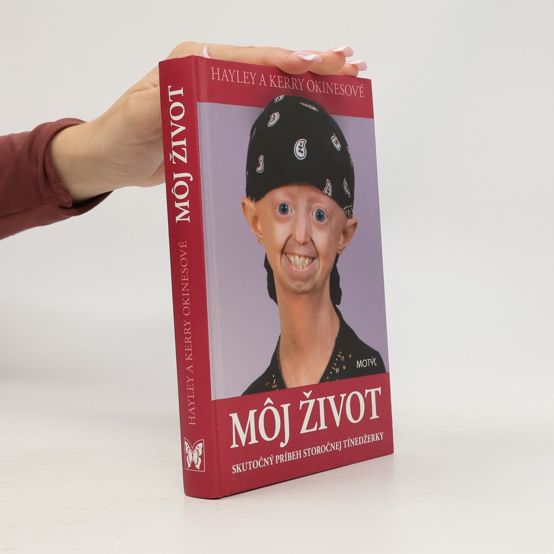Hayley Okines Môj život