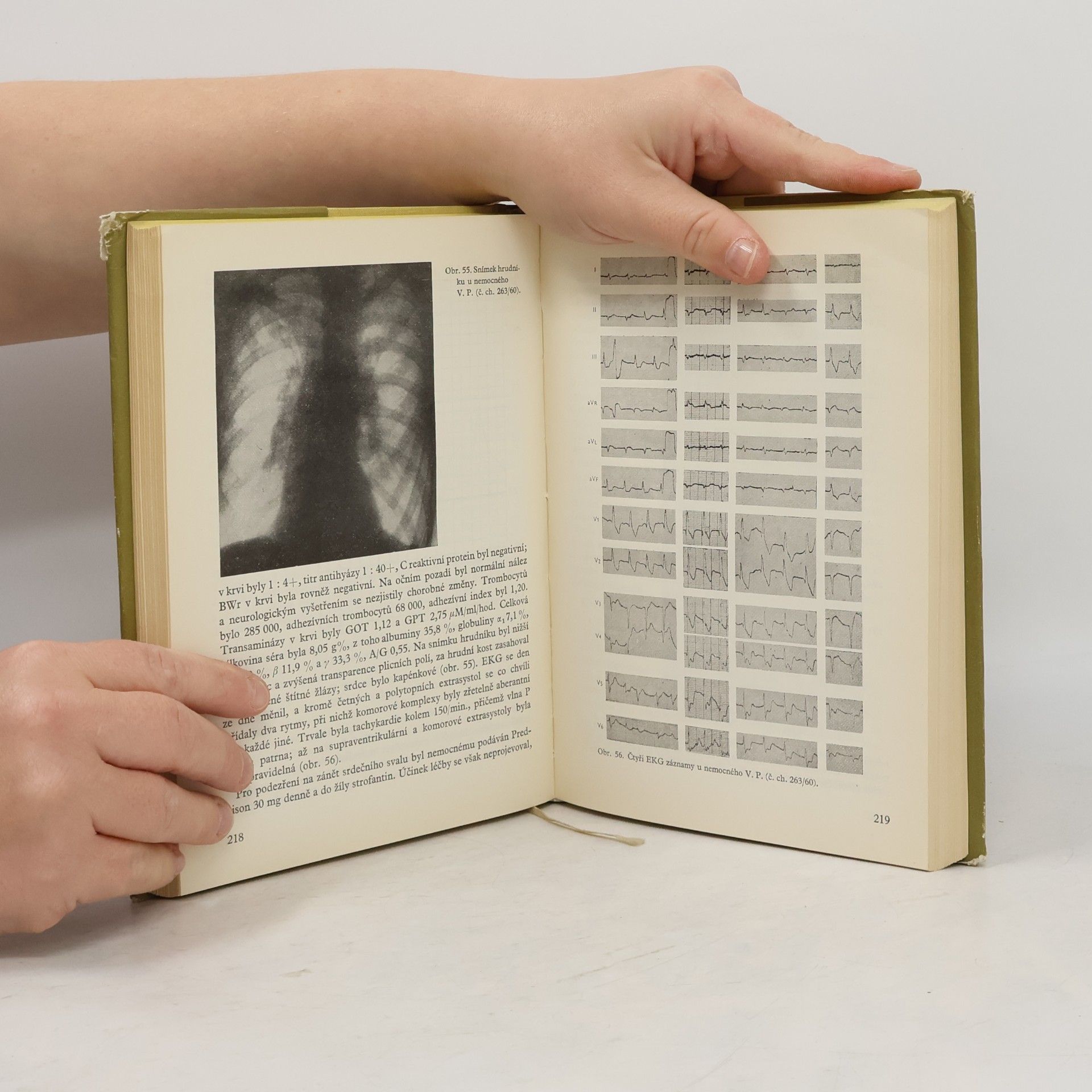 Various authors Omyly a chyby v rozpoznávání vnitřních chorob