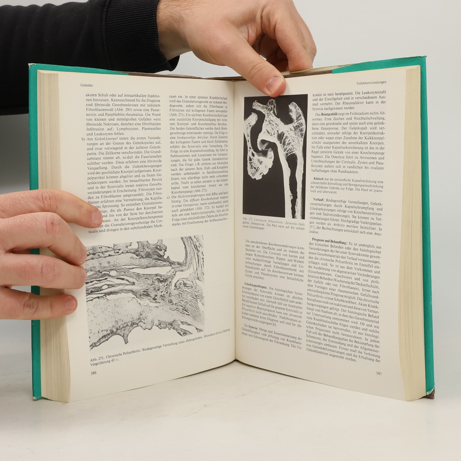 Franz Büchner Spezielle Pathologie. Band 2.