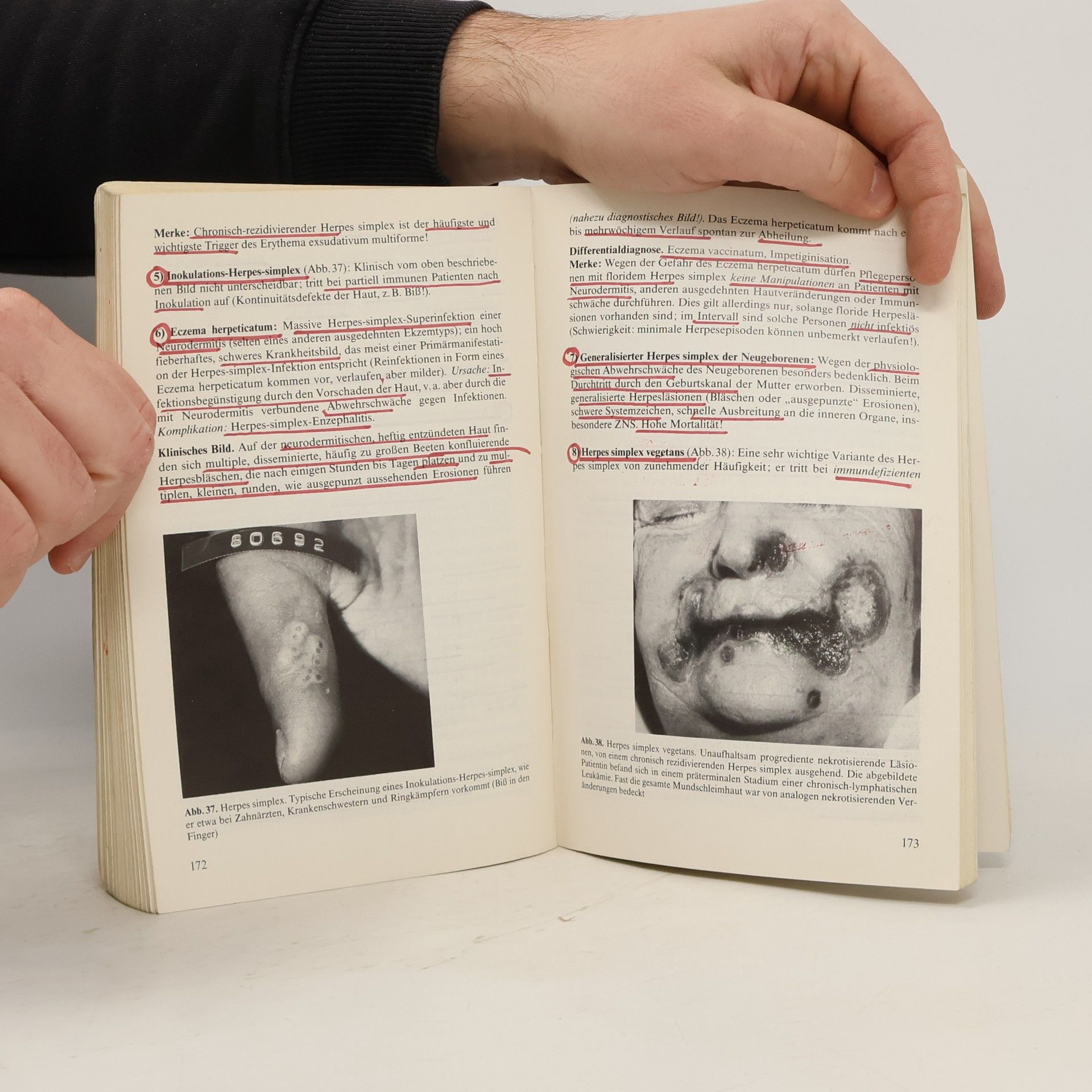 Peter Fritsch Dermatologie