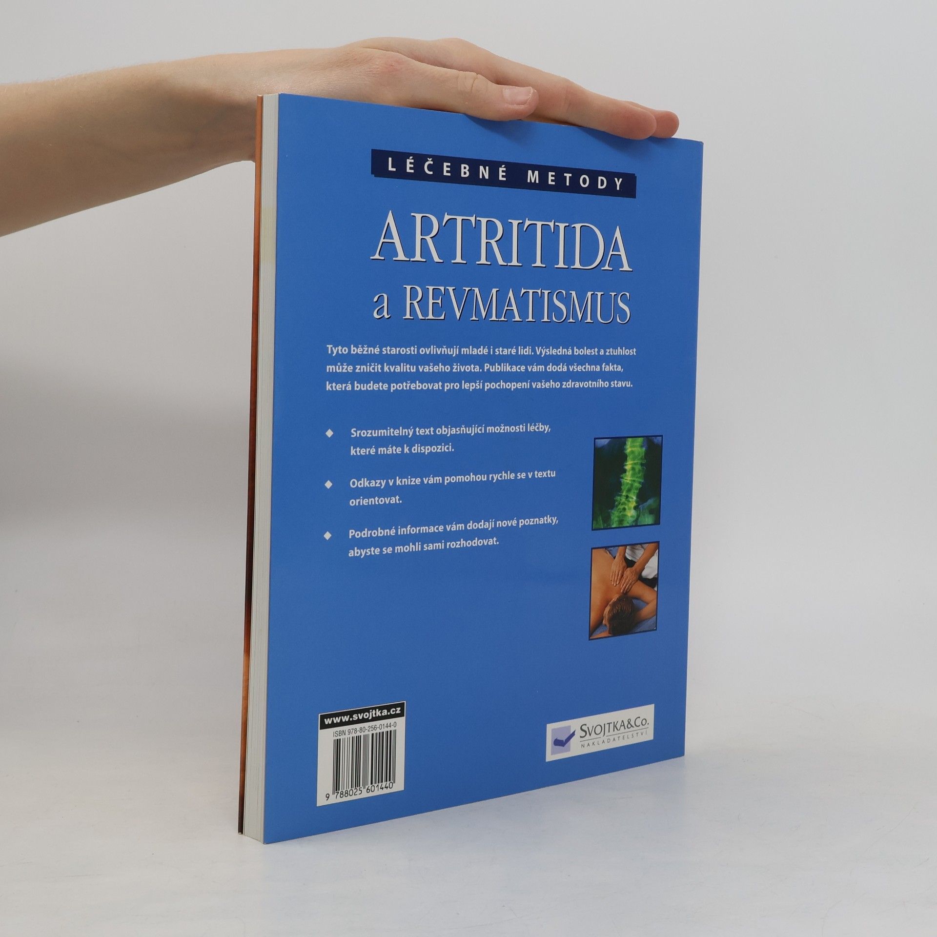 Anne Charlish Artritida a revmatismus