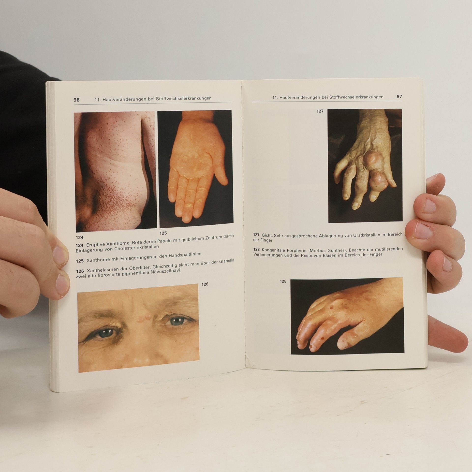 Gerd Klaus Steigleder Taschenatlas der Dermatologie