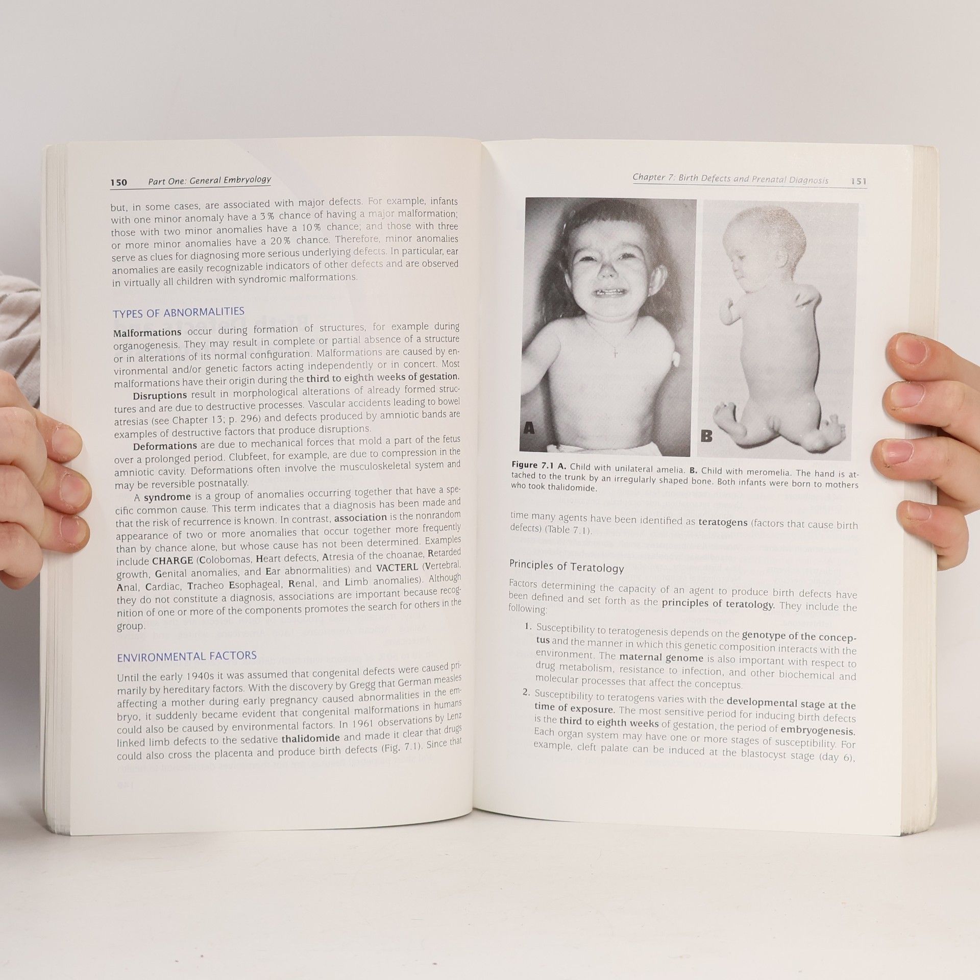Thomas W. Sadler Langman's Medical Embryology