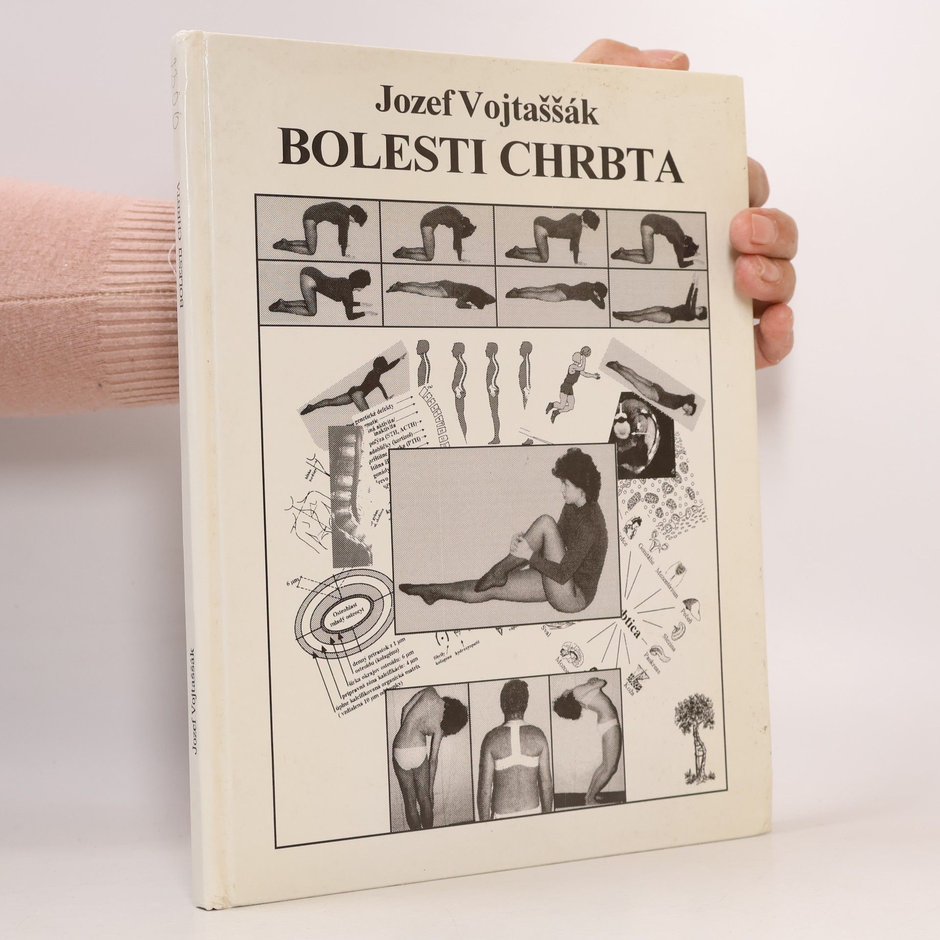 Bolesti chrbta