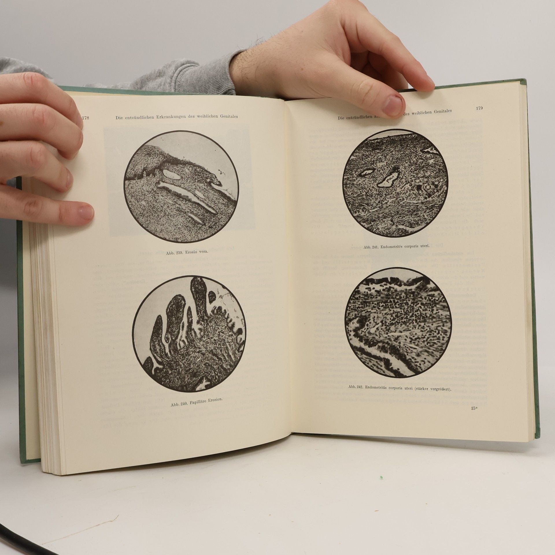 Wilhelm Weibel Lehrbuch der Frauenheilkunde 2. Gynäkologie