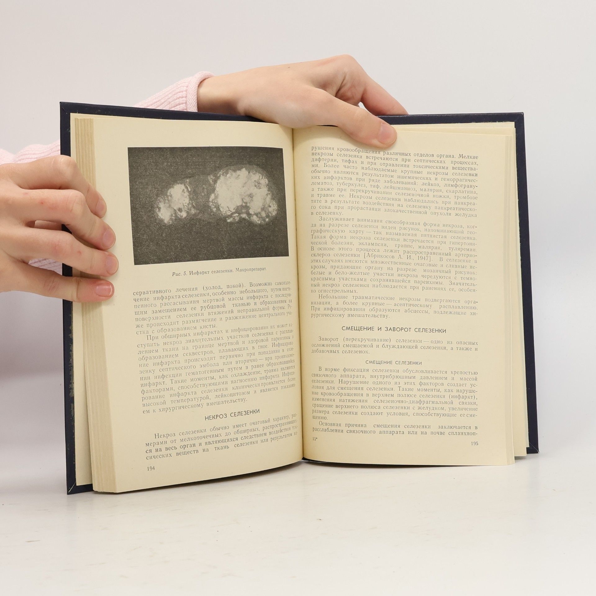 Oleg Konstantinovič Gavrilov Хирургическое лечение заболеваний системы крови