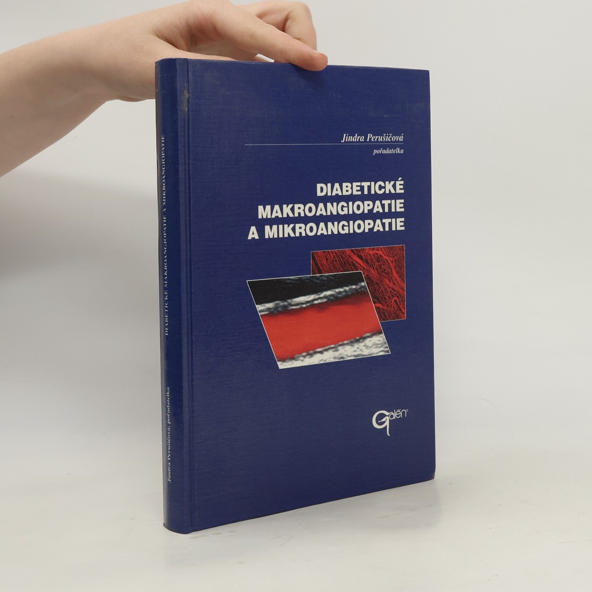 Diabetické makroangiopatie a mikroangiopatie