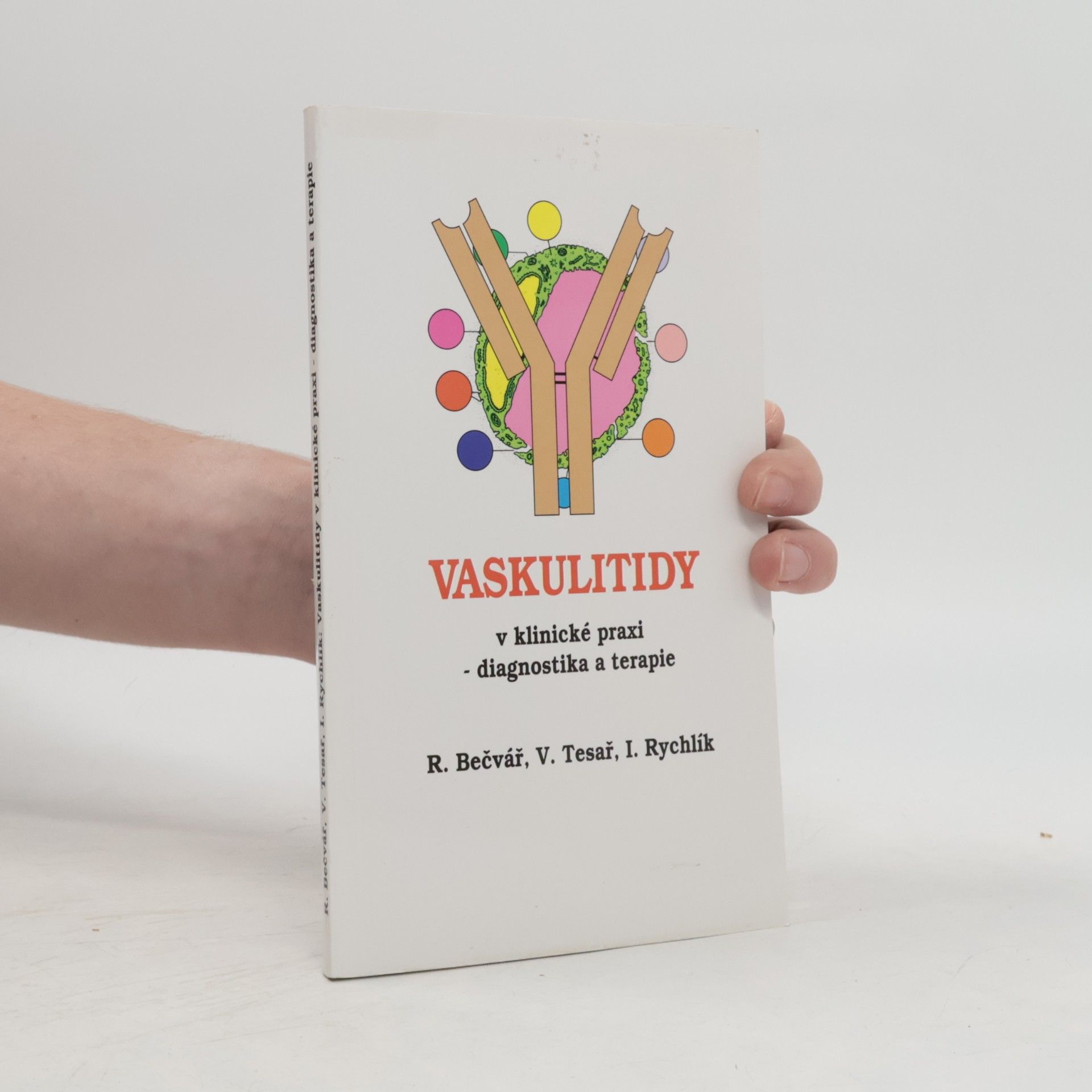 Vaskulitidy v klinické praxi - diagnostika a terapie