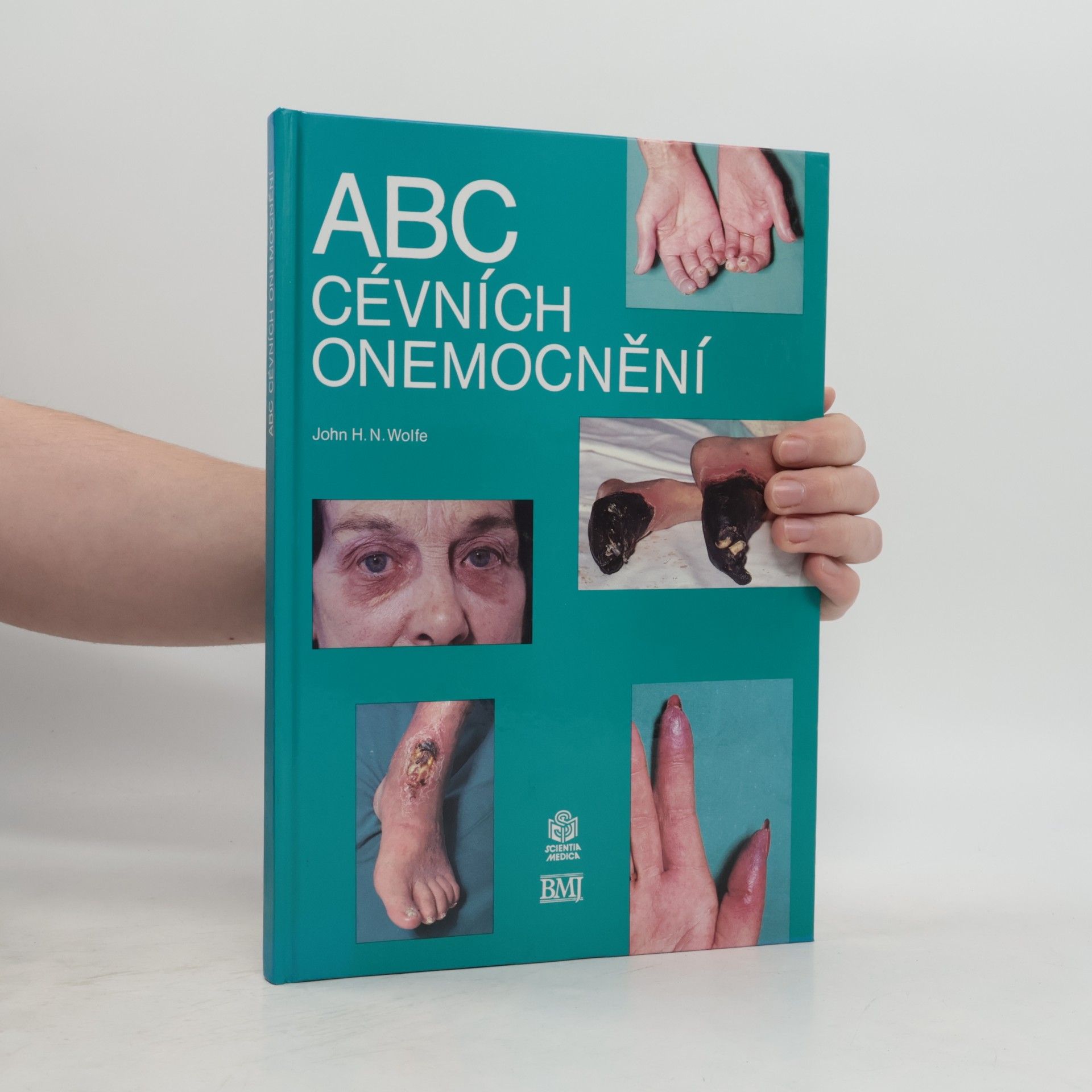 ABC cévních onemocnění
