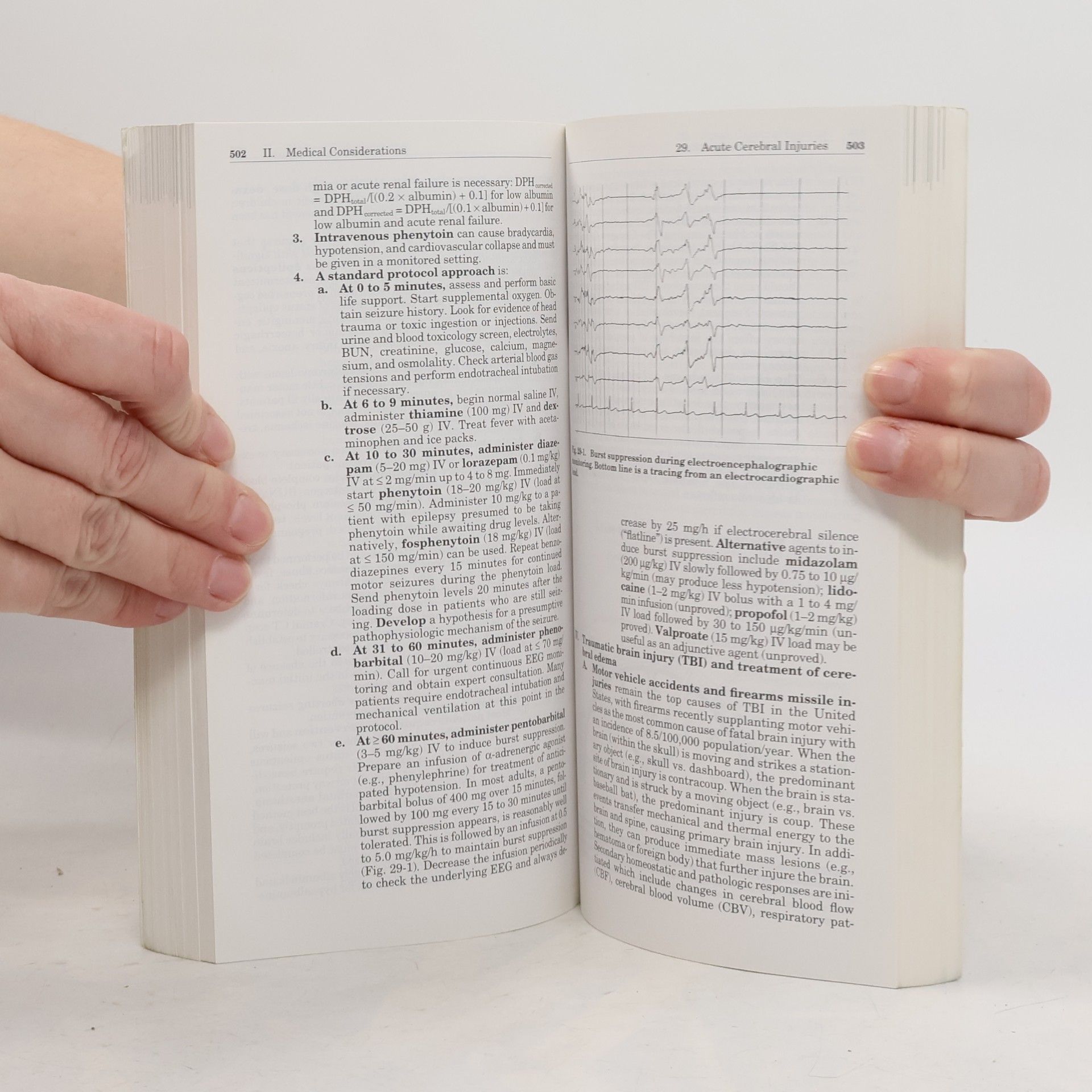 William E. Hurford A Lippincott Williams & Wilkins Handbook: Critical Care Handbook of the Massachusetts General Hospital