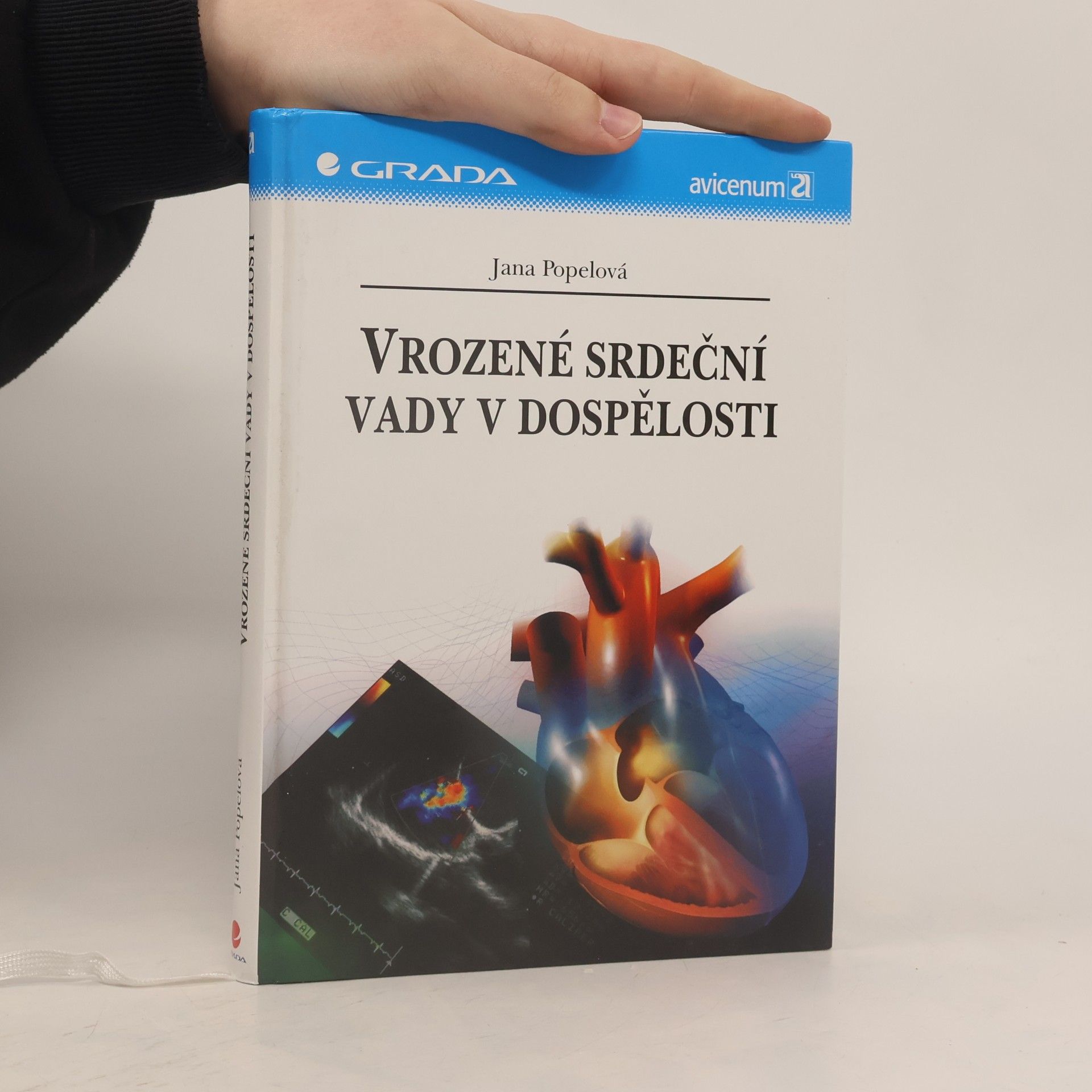 Vrozené srdeční vady v dospělosti