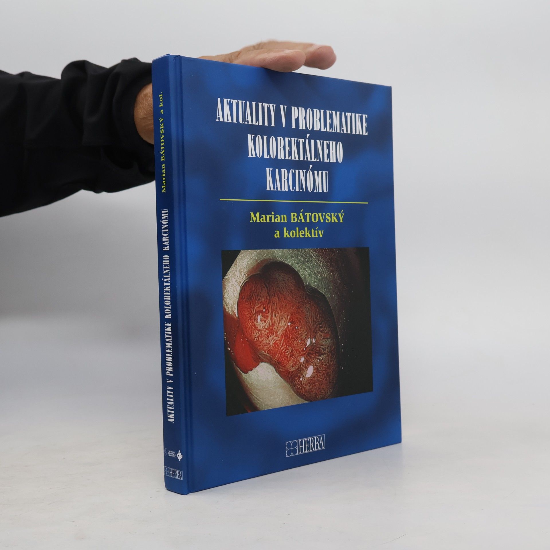Aktuality v problematike kolorektálneho karcinómu