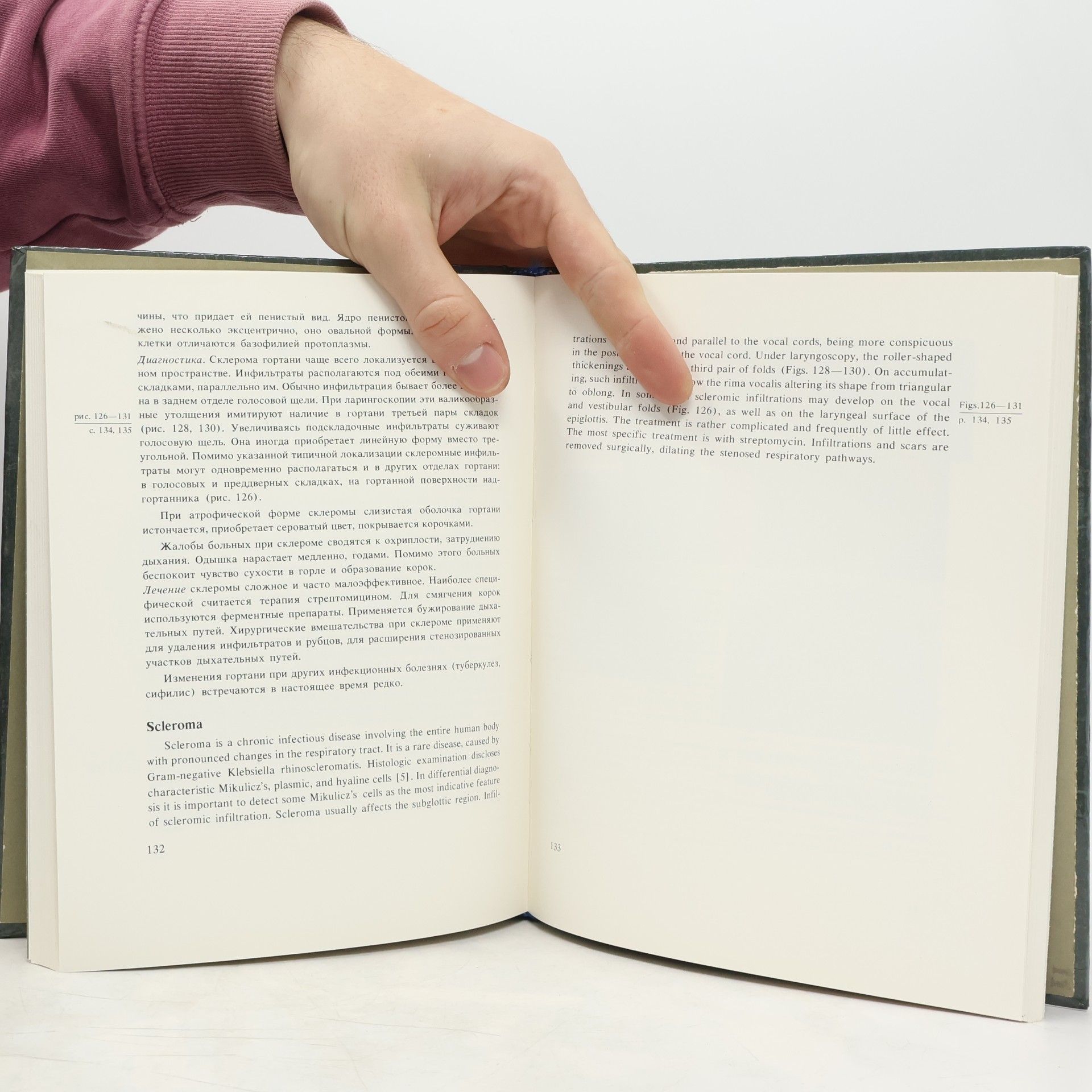 Virgilijus Uloza Atlas of Laryngeal Diseases. Gerklų ligų atlasas. Aтлас болезней гортани.