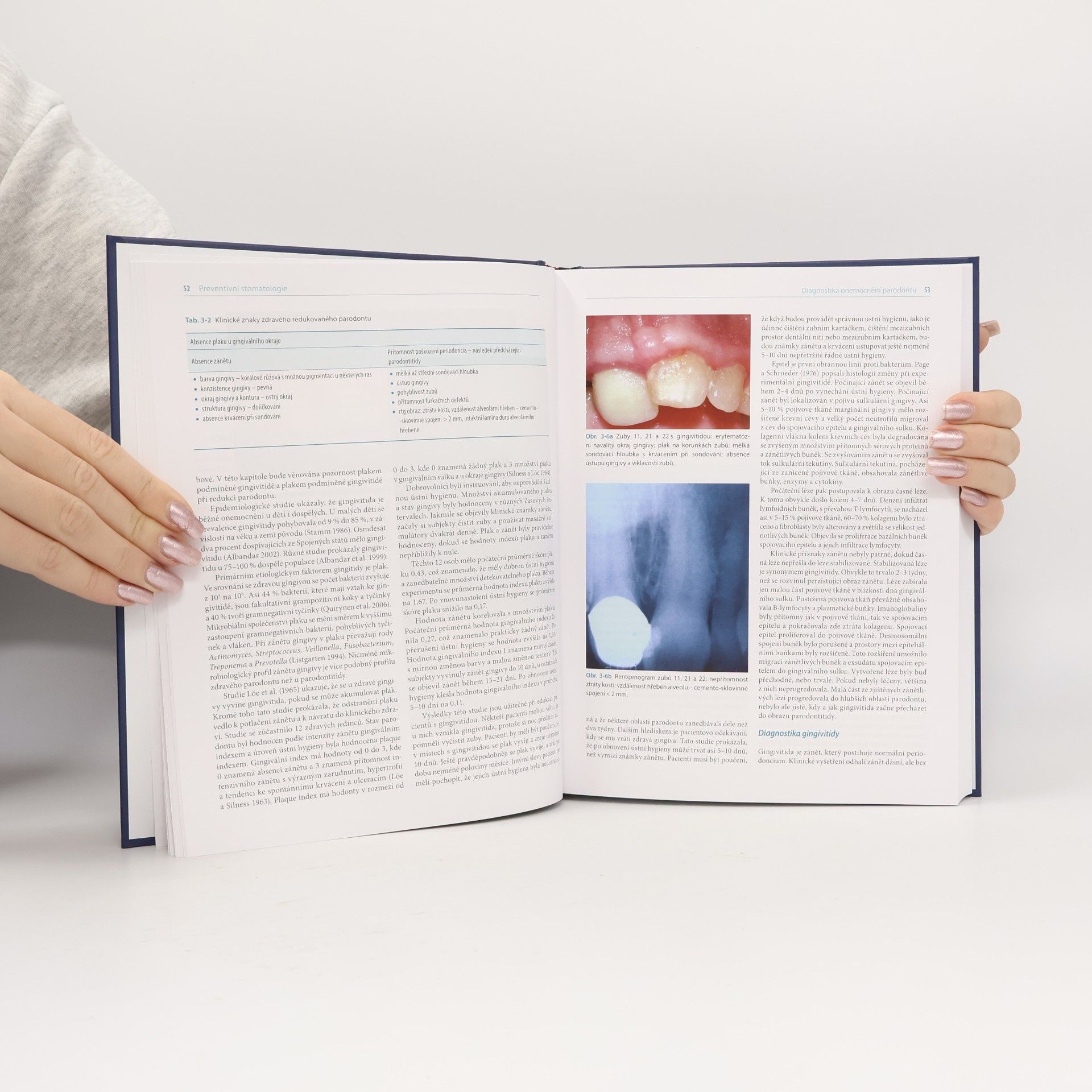 Hardy Limeback Preventivní stomatologie