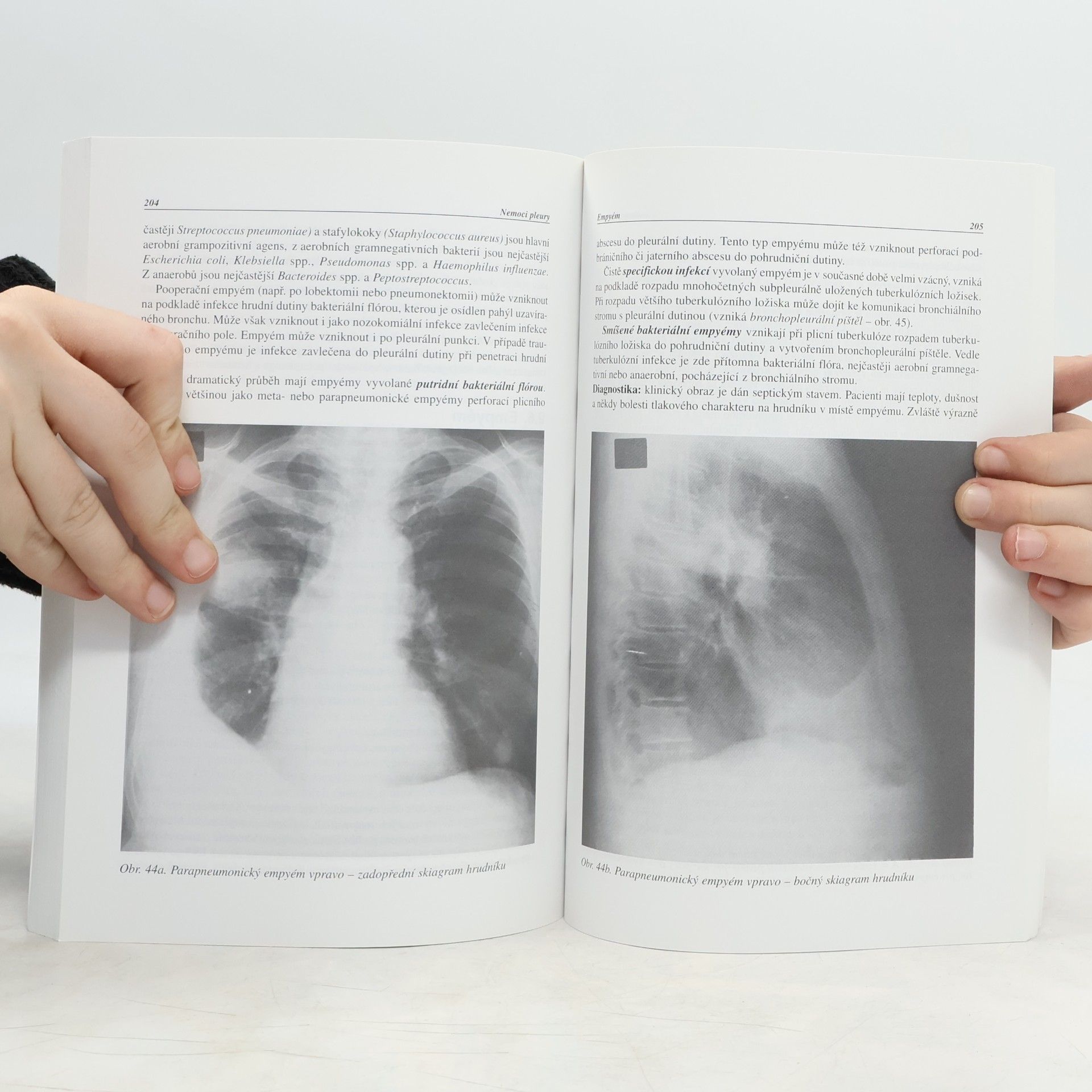 Anna Schneider Pneumologie - Vnitřní lékařství, díl IIIa