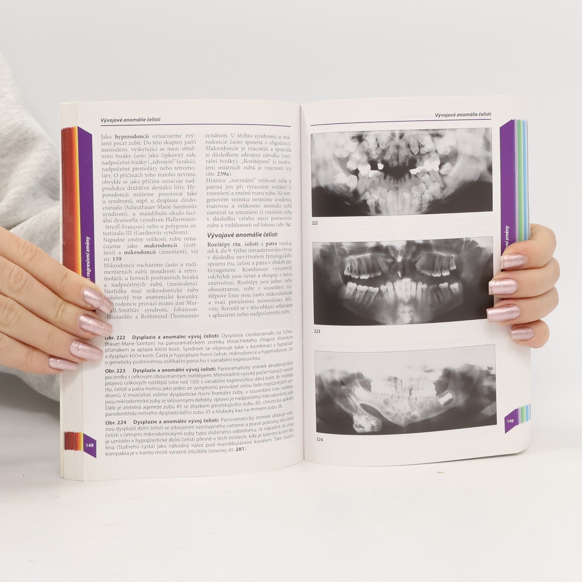 Auteurscollectief Stomatologická radiologie