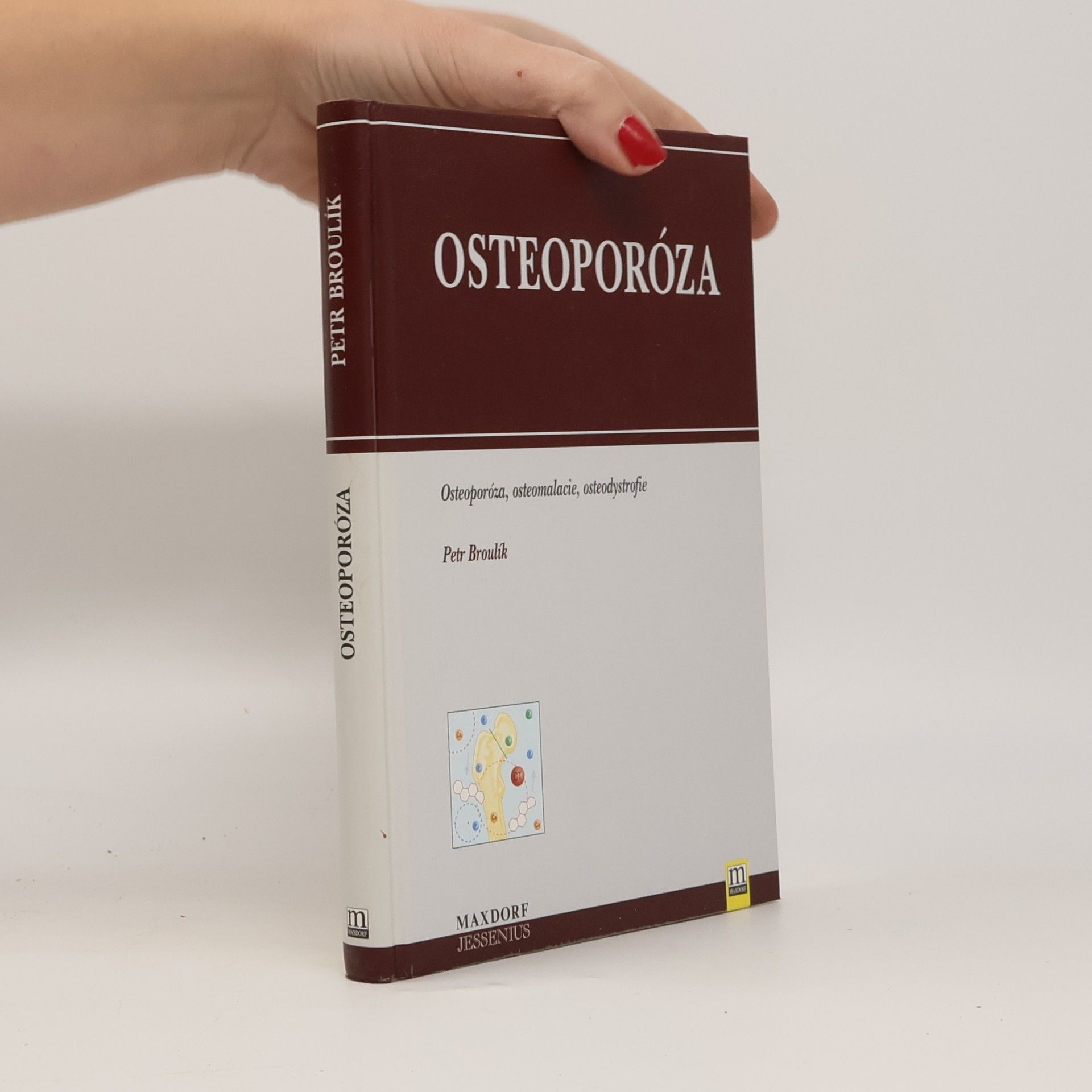 Petr Broulík Osteoporóza: osteoporóza, osteomalacie, osteodystrofie