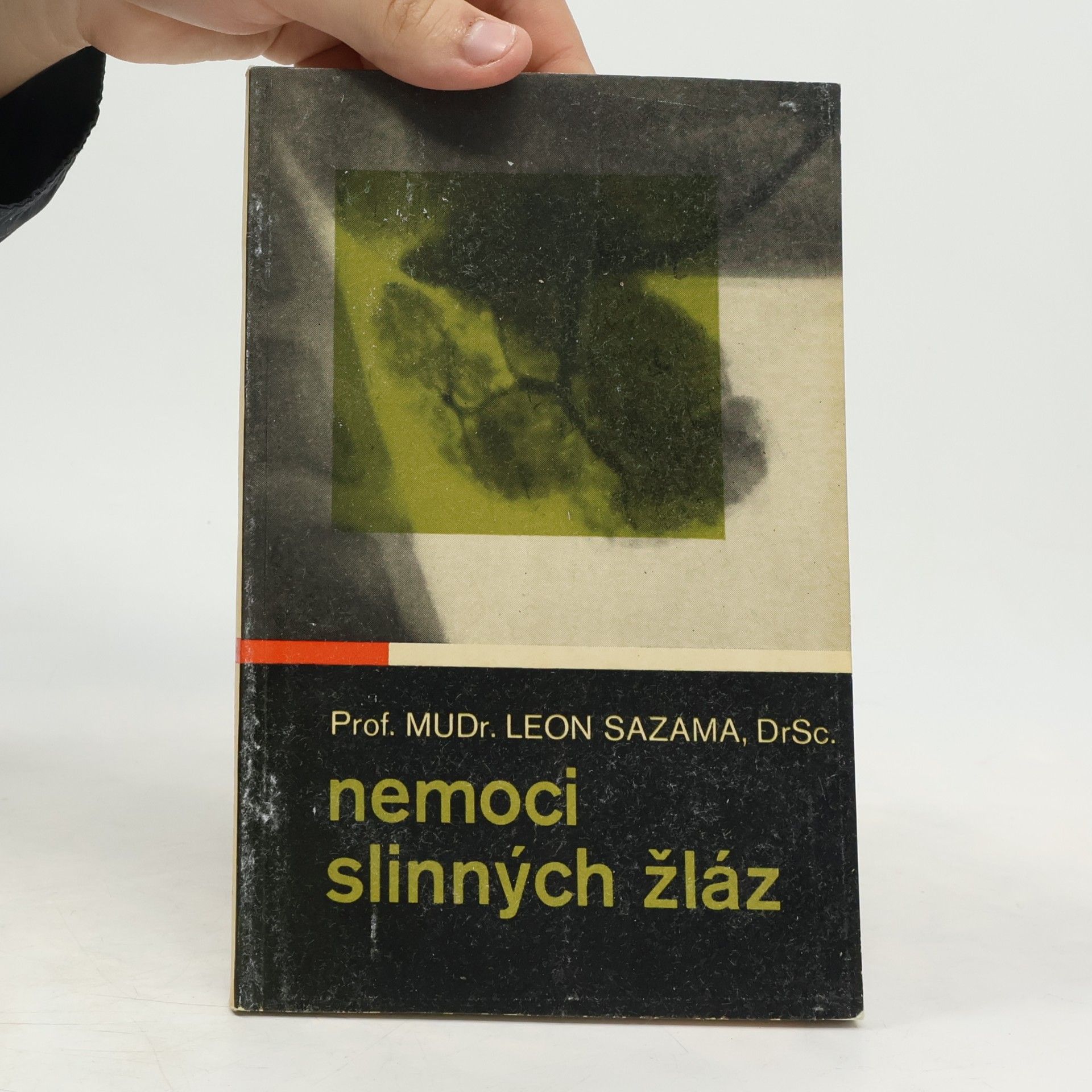 Leon Sazama Nemoci slinných žláz