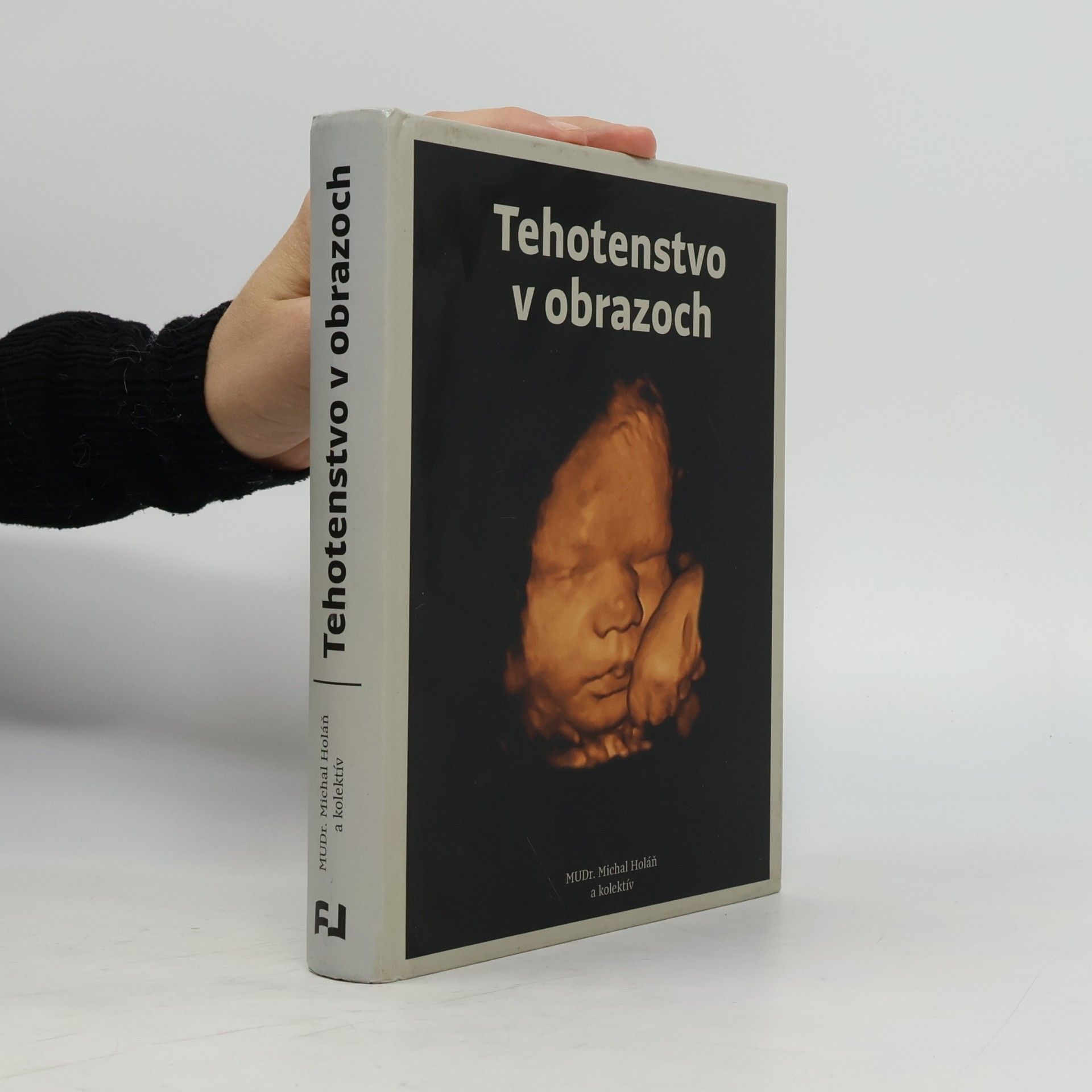 Collectif d'auteurs Tehotenstvo v obrazoch