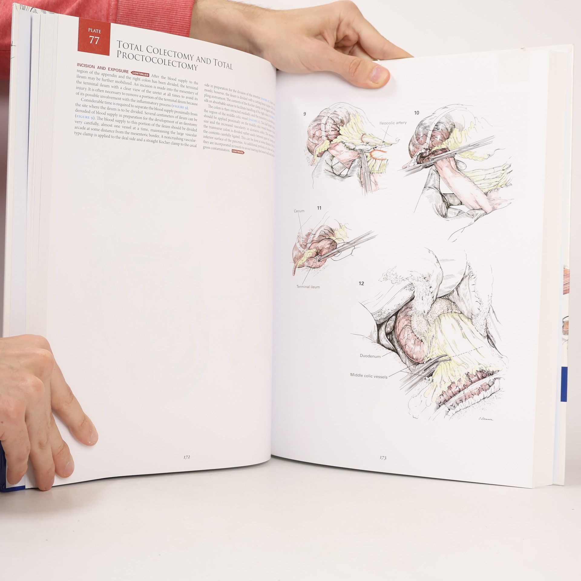 Robert M. Zollinger, Jr. Zollinger's Atlas of Surgical Operations