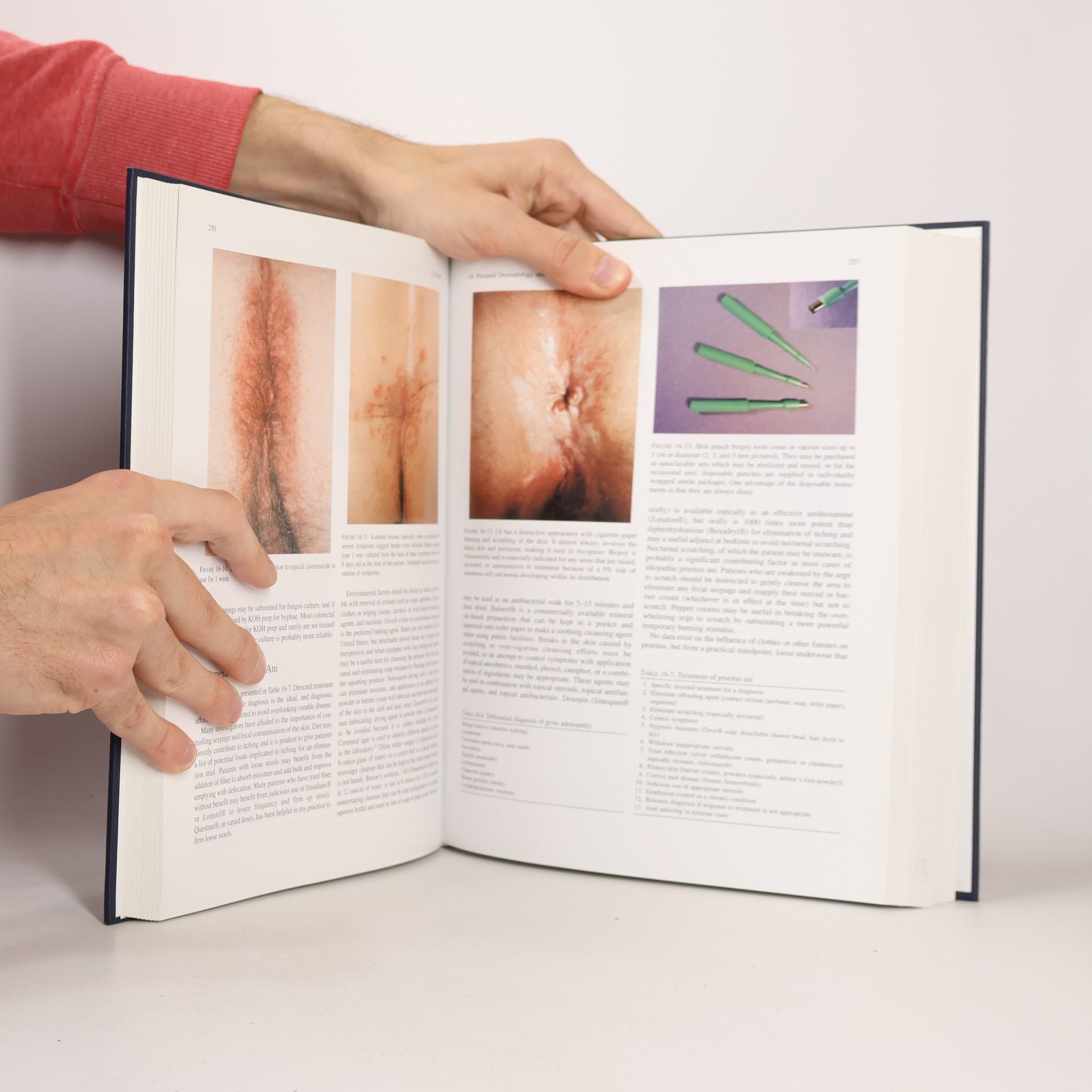 Bruce G. Wolff The ASCRS Textbook of Colon and Rectal Surgery