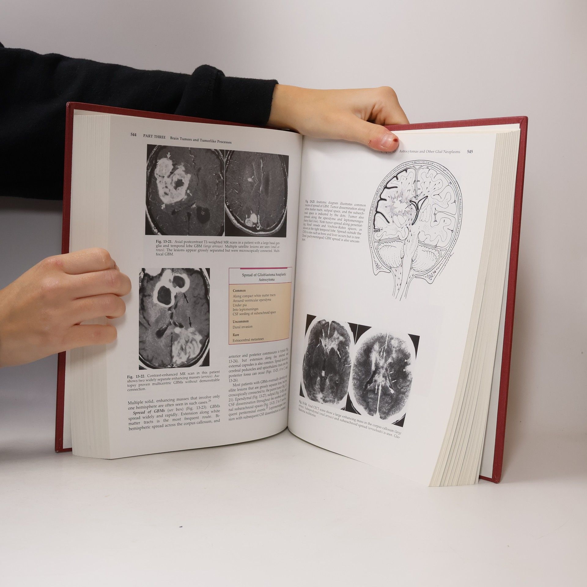 Anne G. Osborn DIAGNOSTIC NEURORADIOLOGY