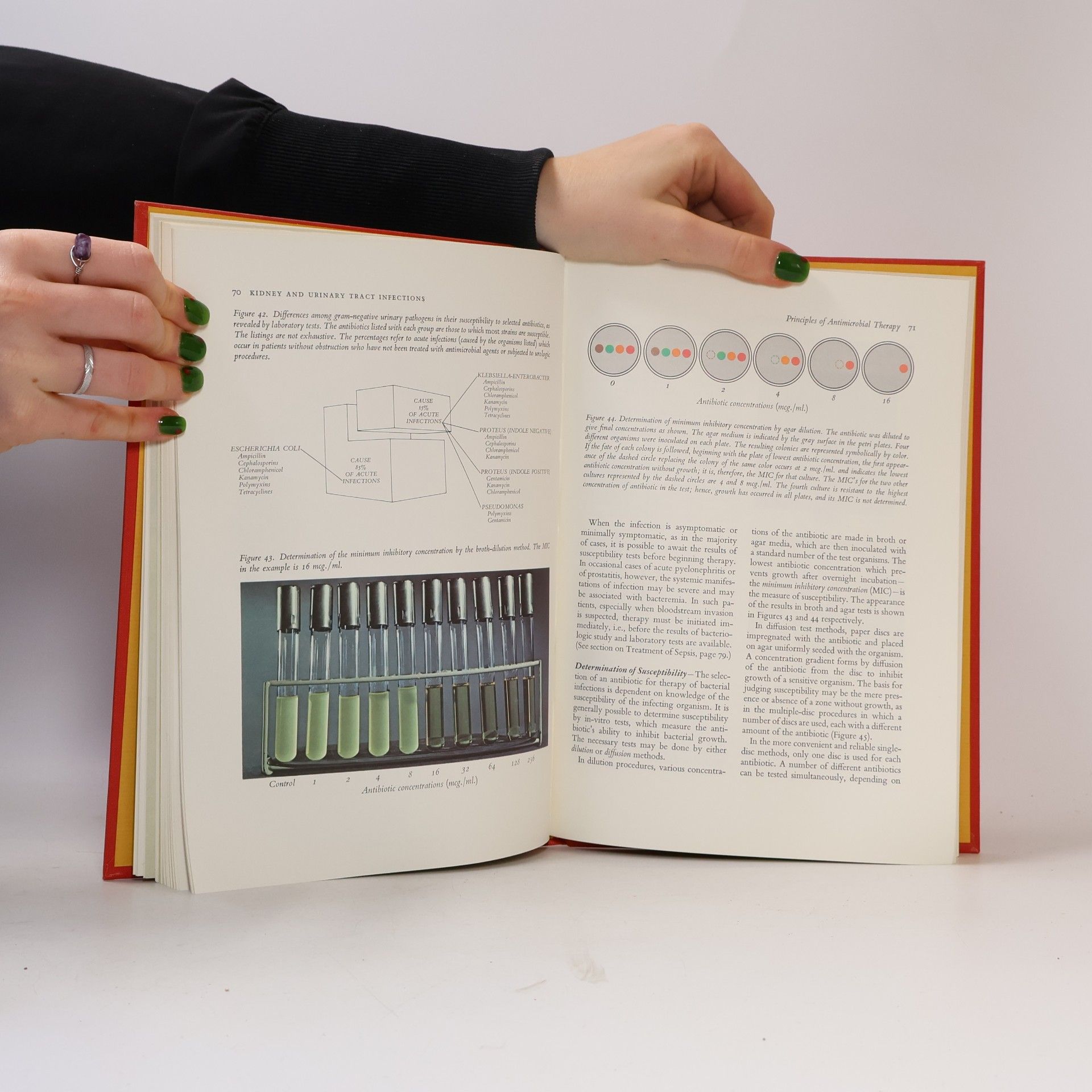Various authors Kidney and Urinary Tract Infections
