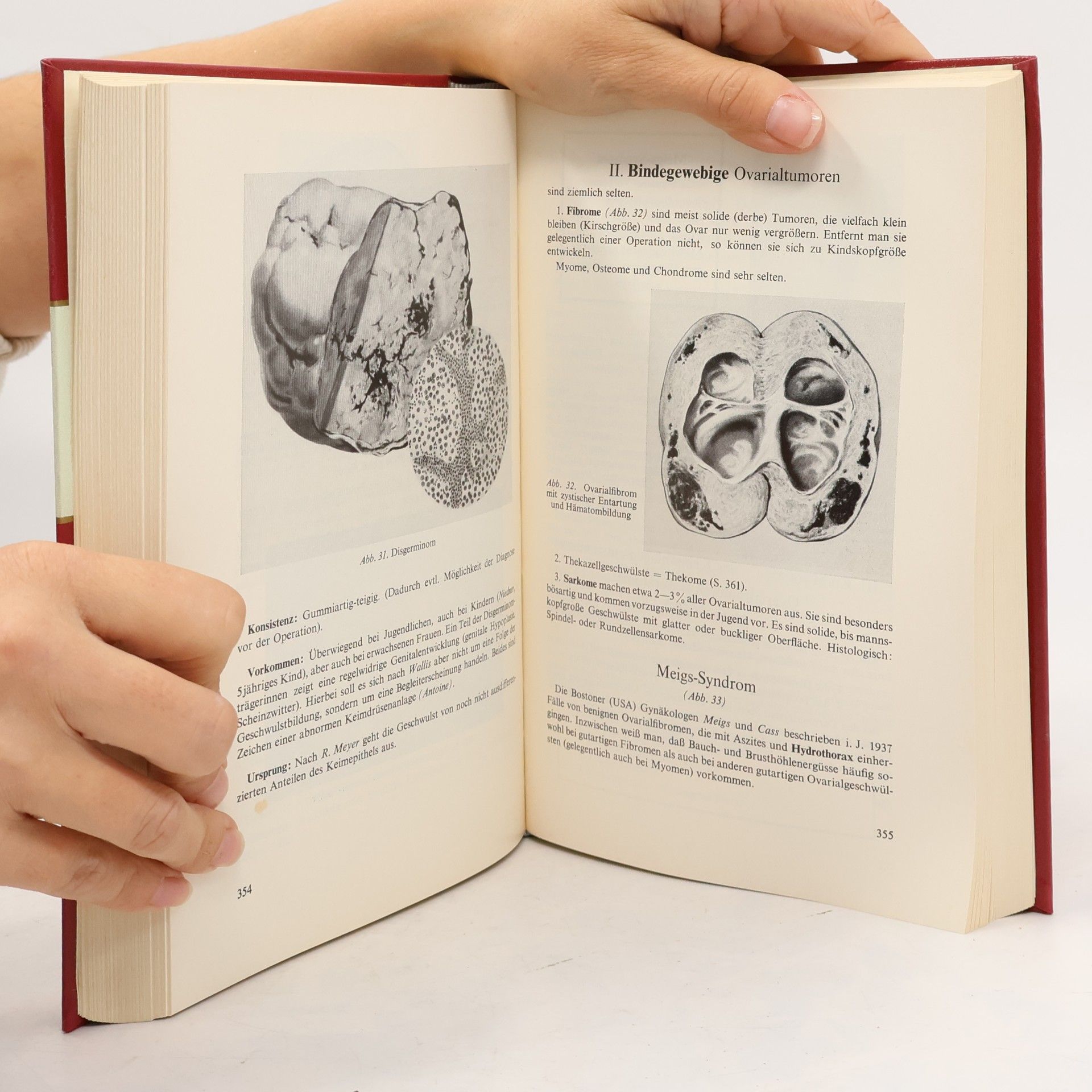 Willibald Pschyrembel Praktische Gynäkologie. Für Studierende und Ärzte