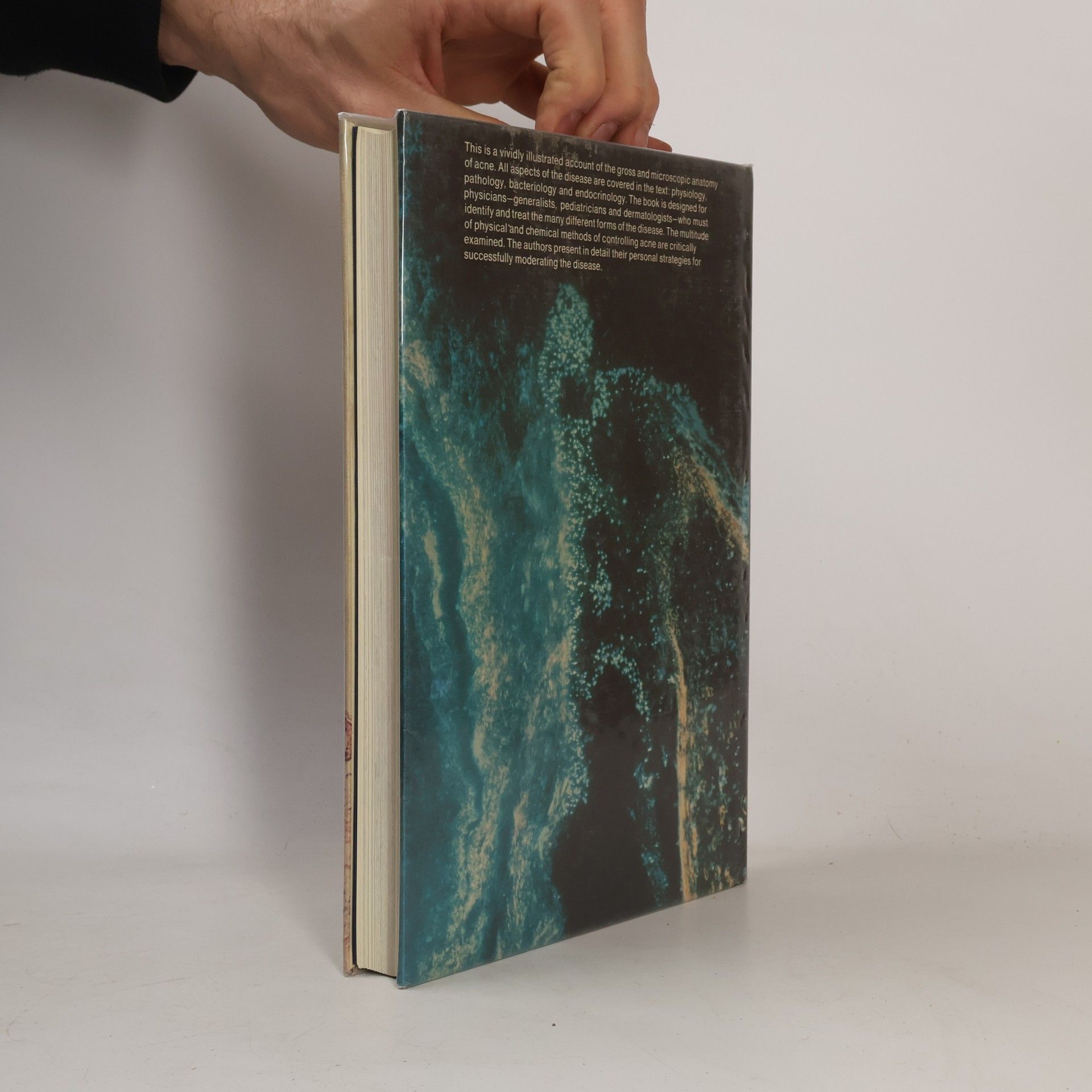 Gerd Plewig Acne