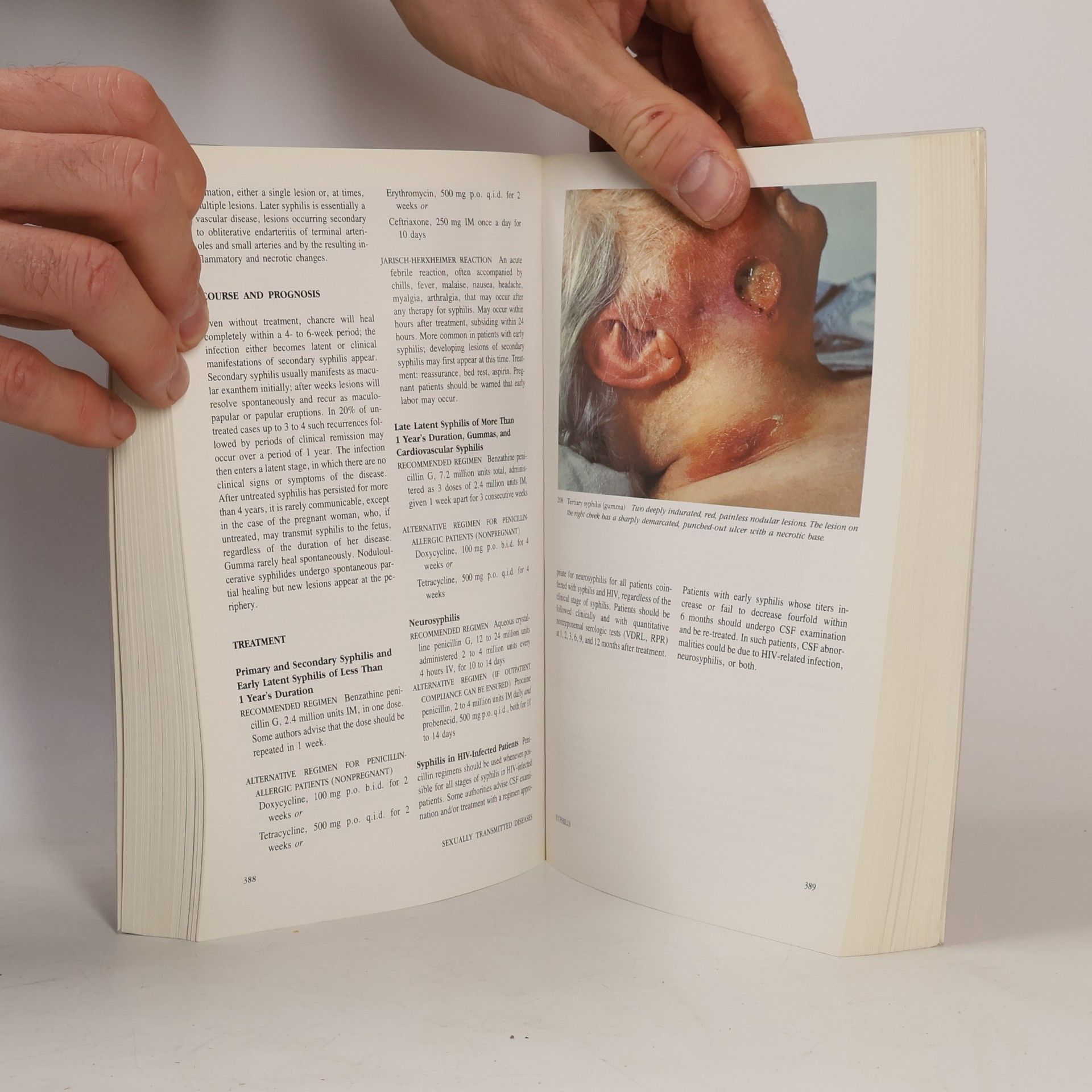 Thomas B. Thomas Bernard Fitzpatrick Color Atlas and Synopsis of Clinical Dermatology