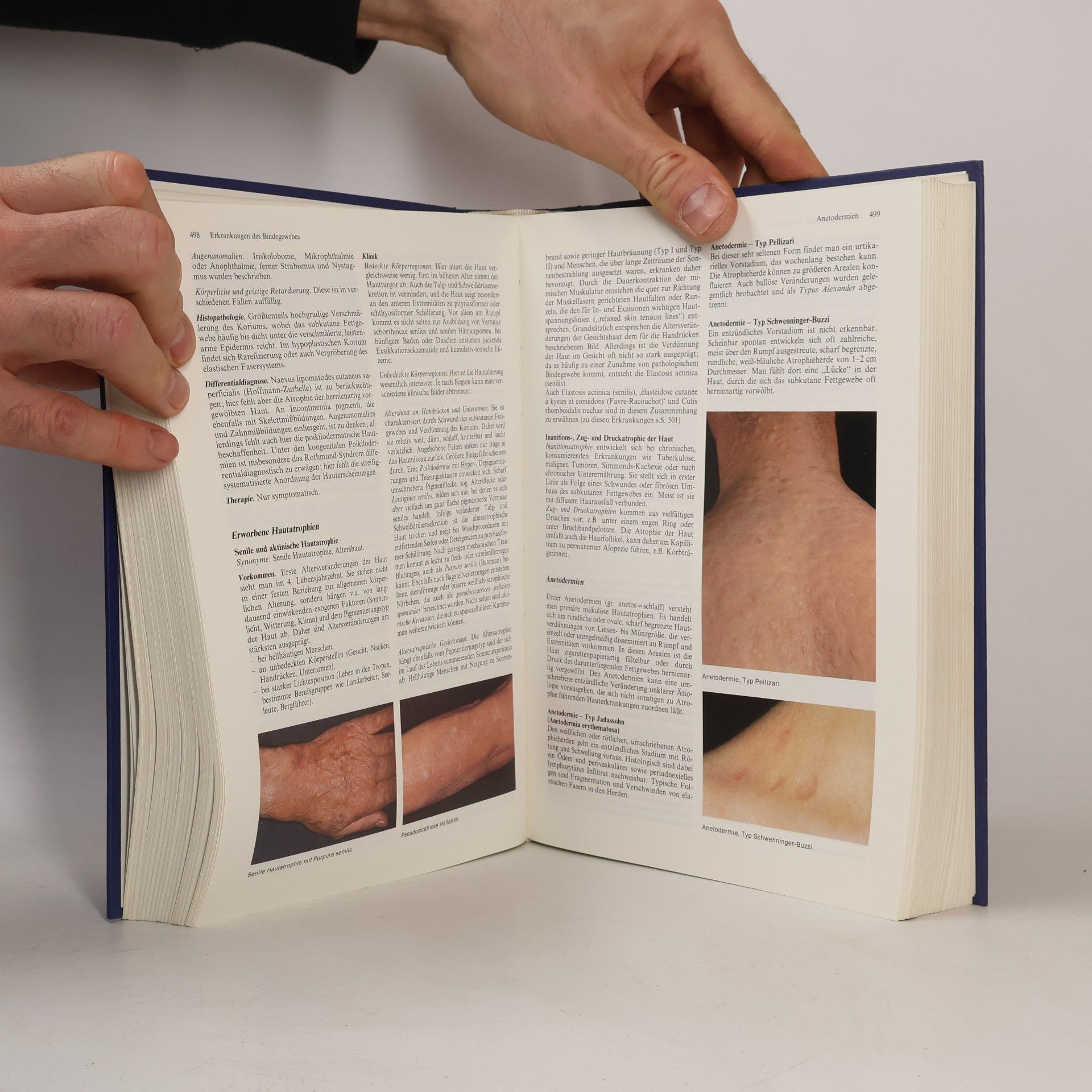 Otto Braun-Falco Dermatologie und Venerologie