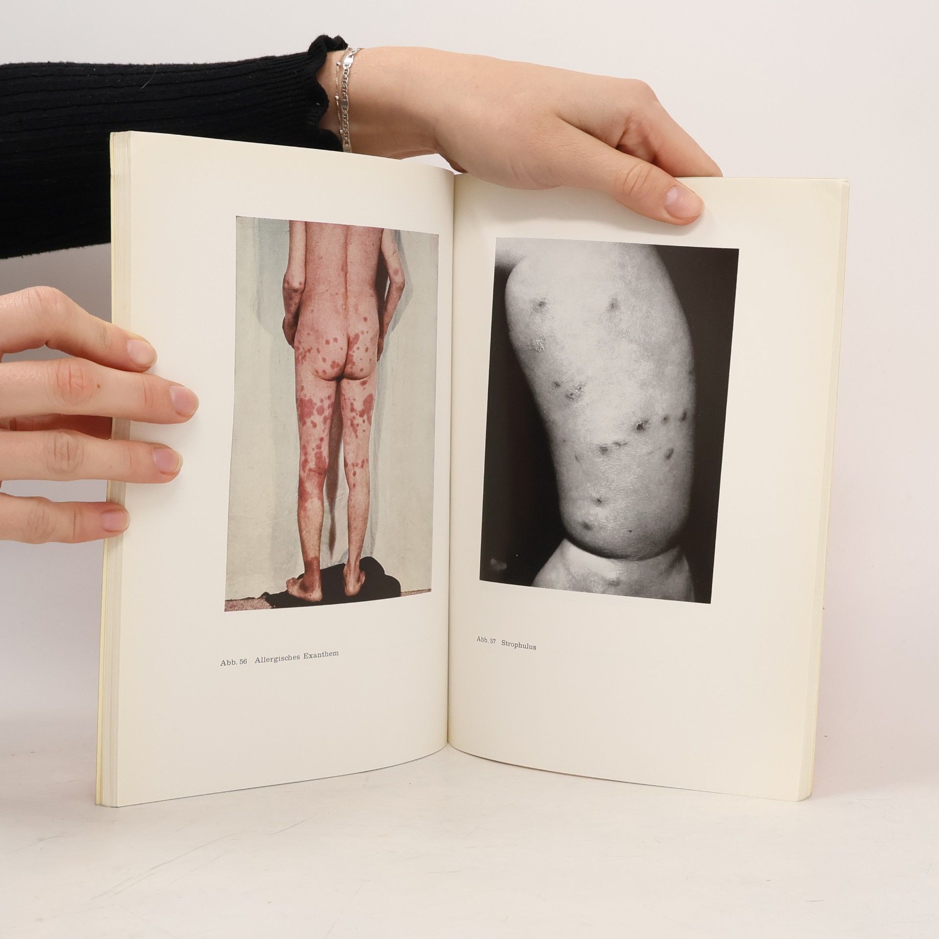 Rudolf Maximilian Bohnstedt Medizin von heute 21. Dermatologie