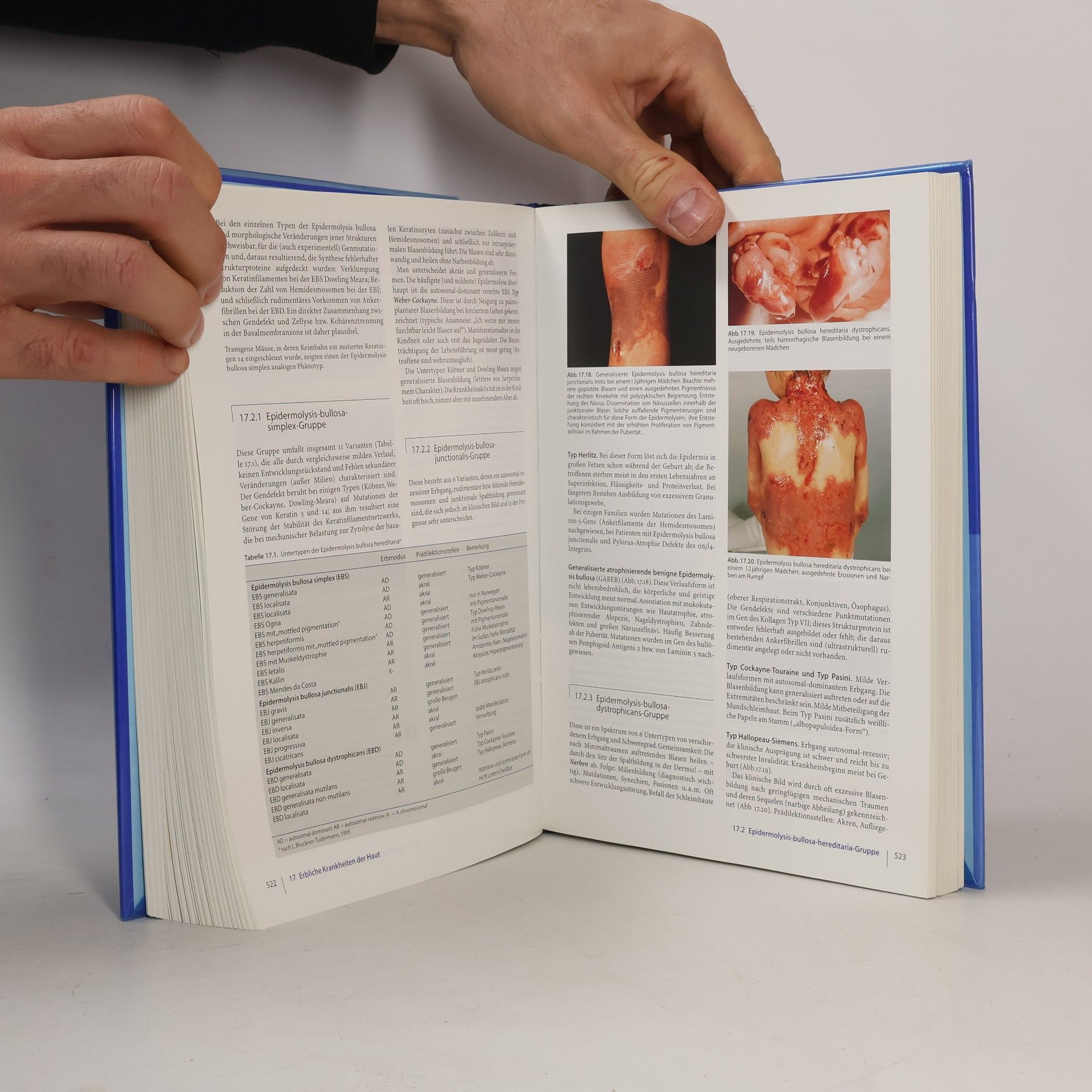 Peter Fritsch Springer-Lehrbuch: Dermatologie und Venerologie