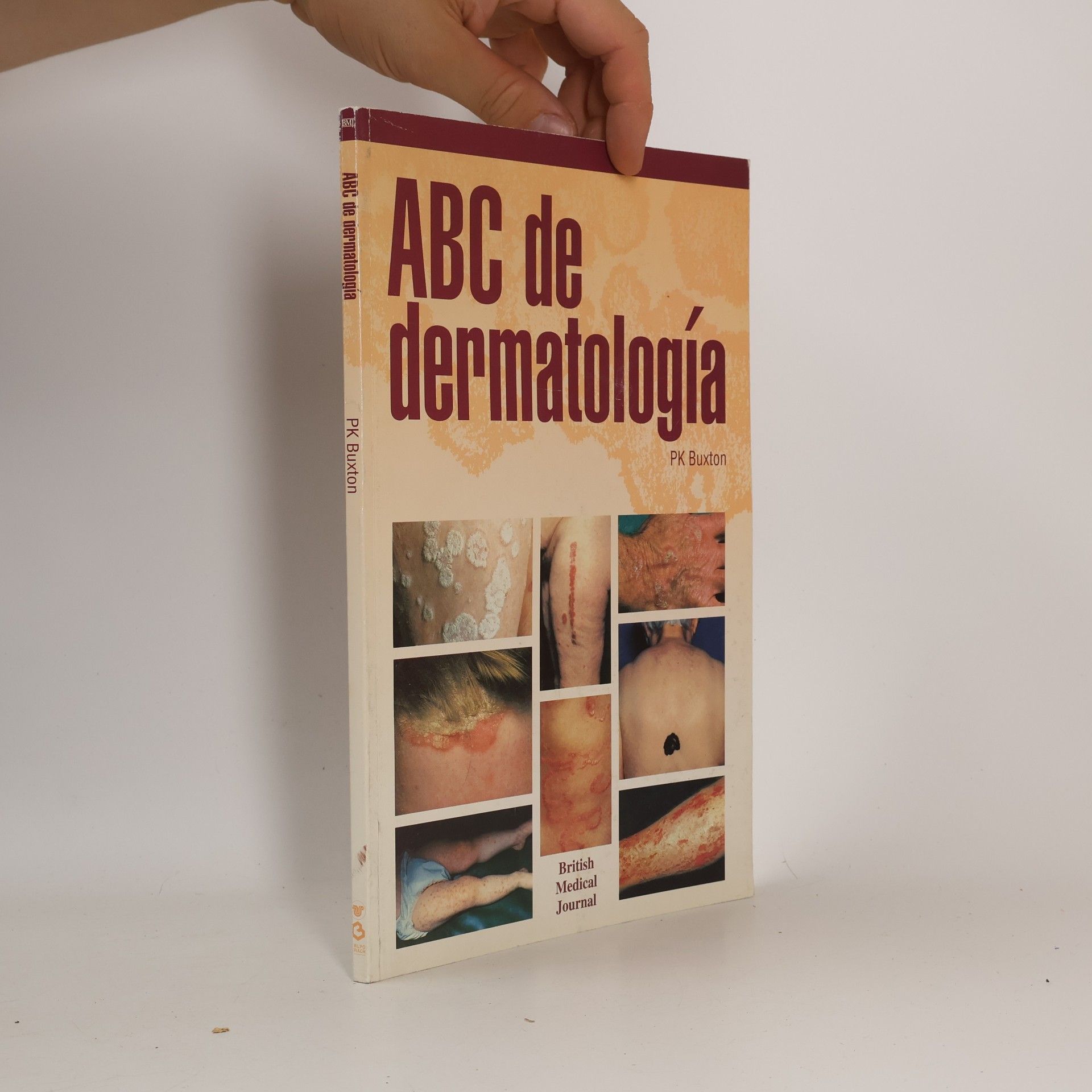 ABC de dermatología