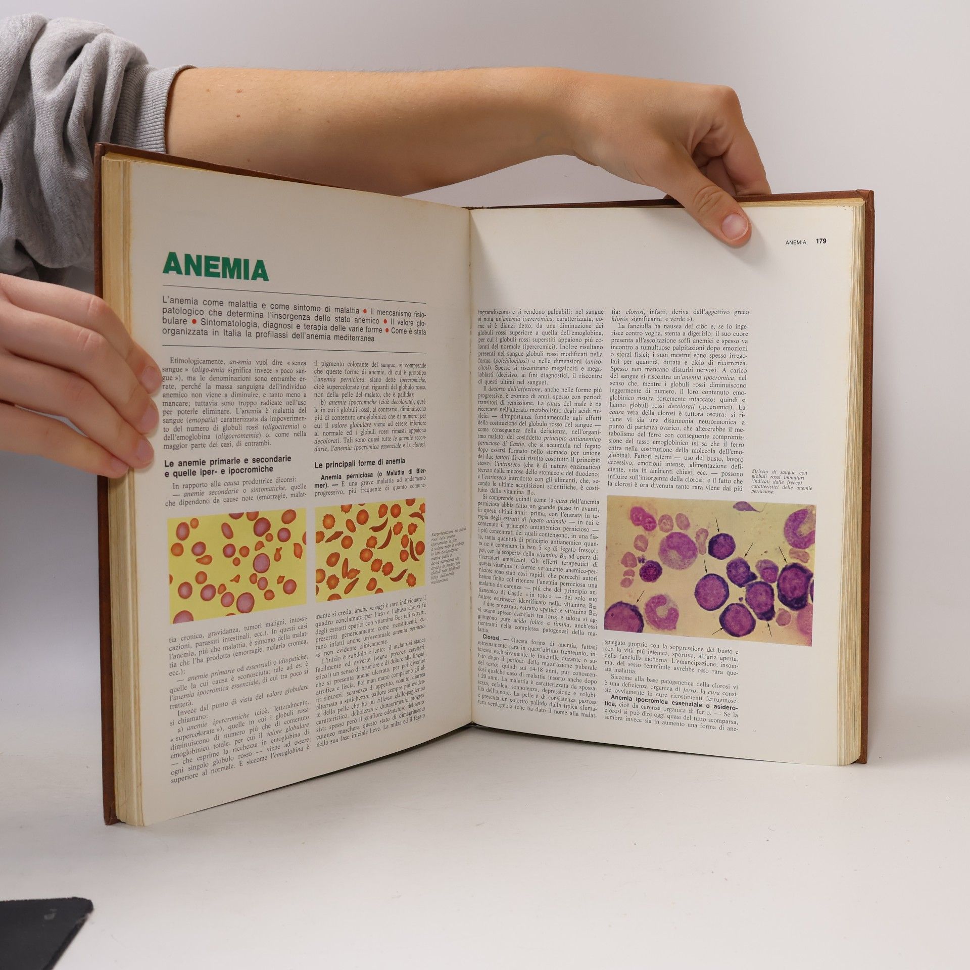 Various authors l'enciclopedia MEDICA di tutti volume primo A - ASTI
