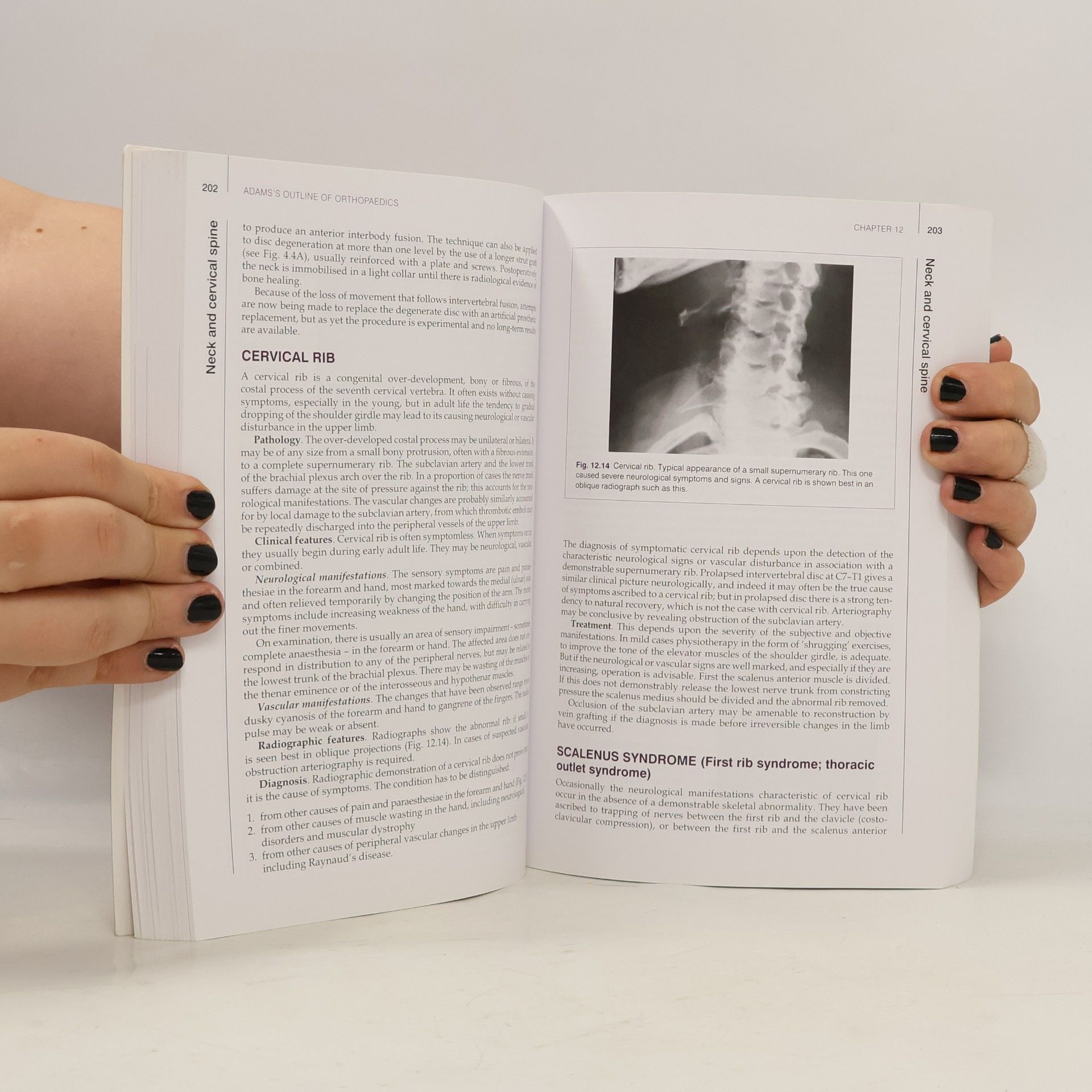 E. C. Tubb Adams's Outline of Orthopaedics Fourteenth Edition