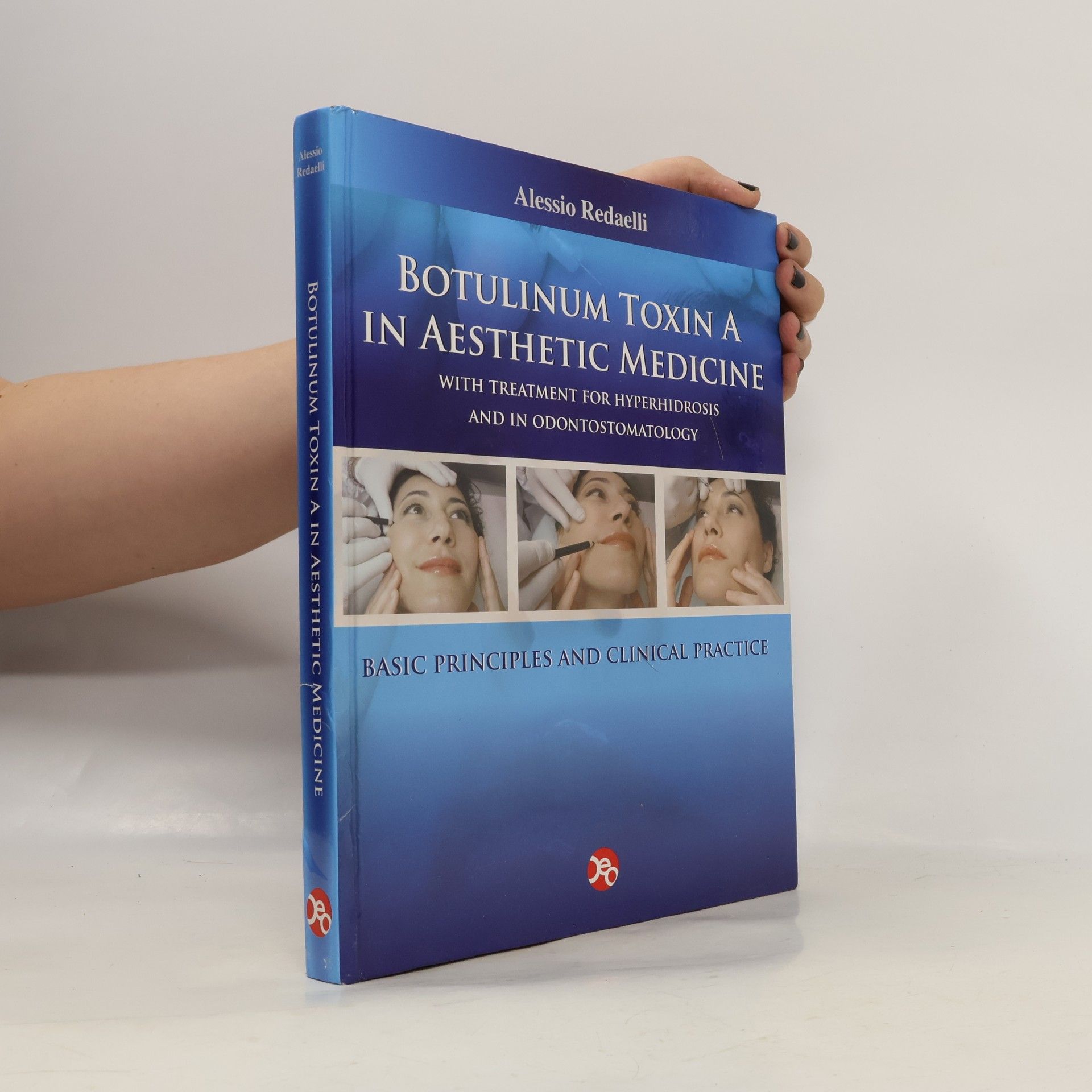 Alessio Redaelli Botulinum Toxin A in Aesthetic Medicine
