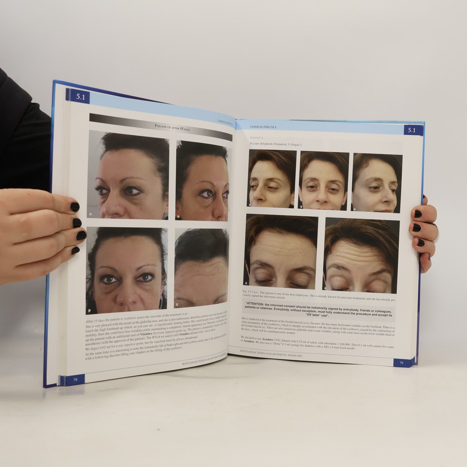 Alessio Redaelli Botulinum Toxin A in Aesthetic Medicine