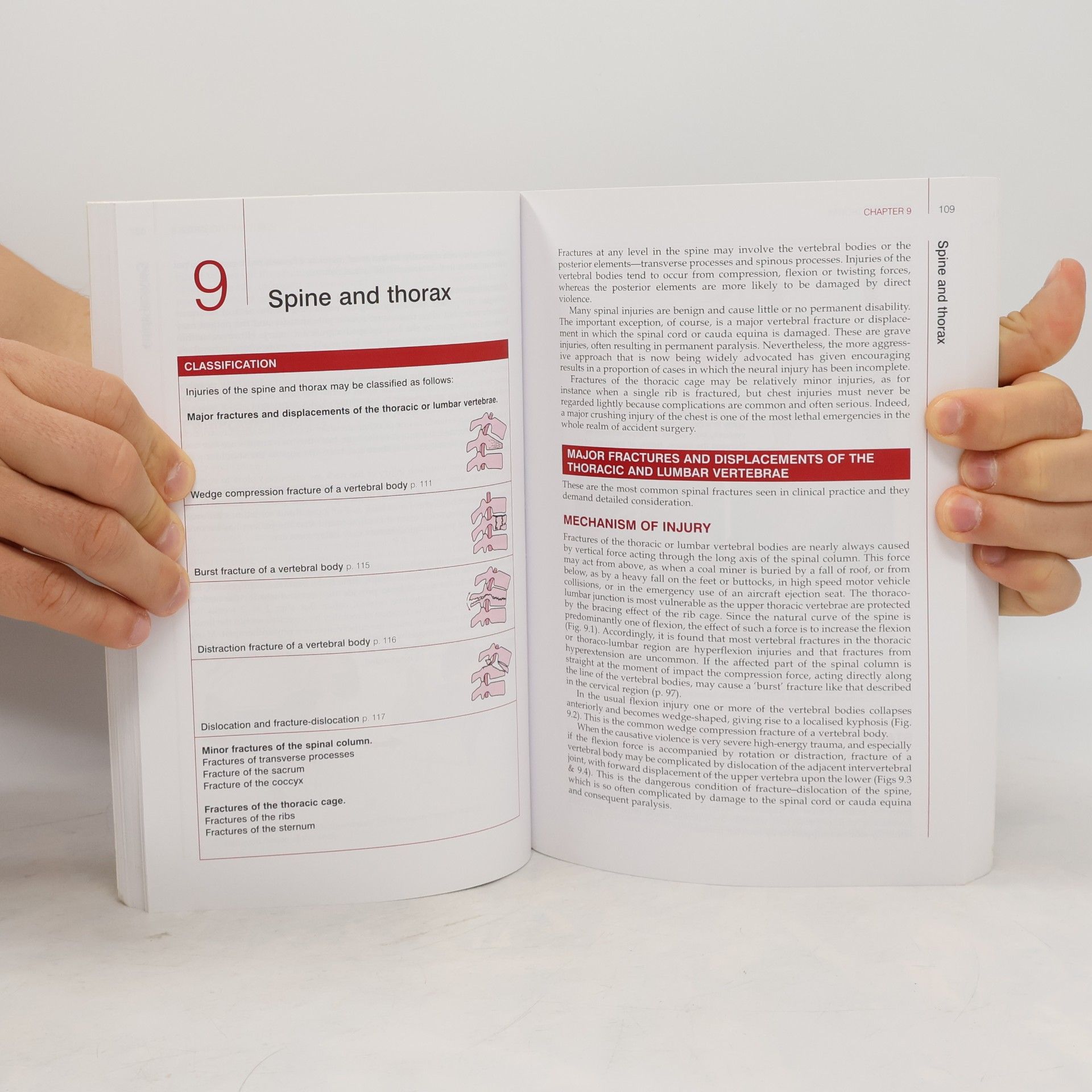 David L. Hamblen Adams's Outline of Fractures - Twelfth Edition