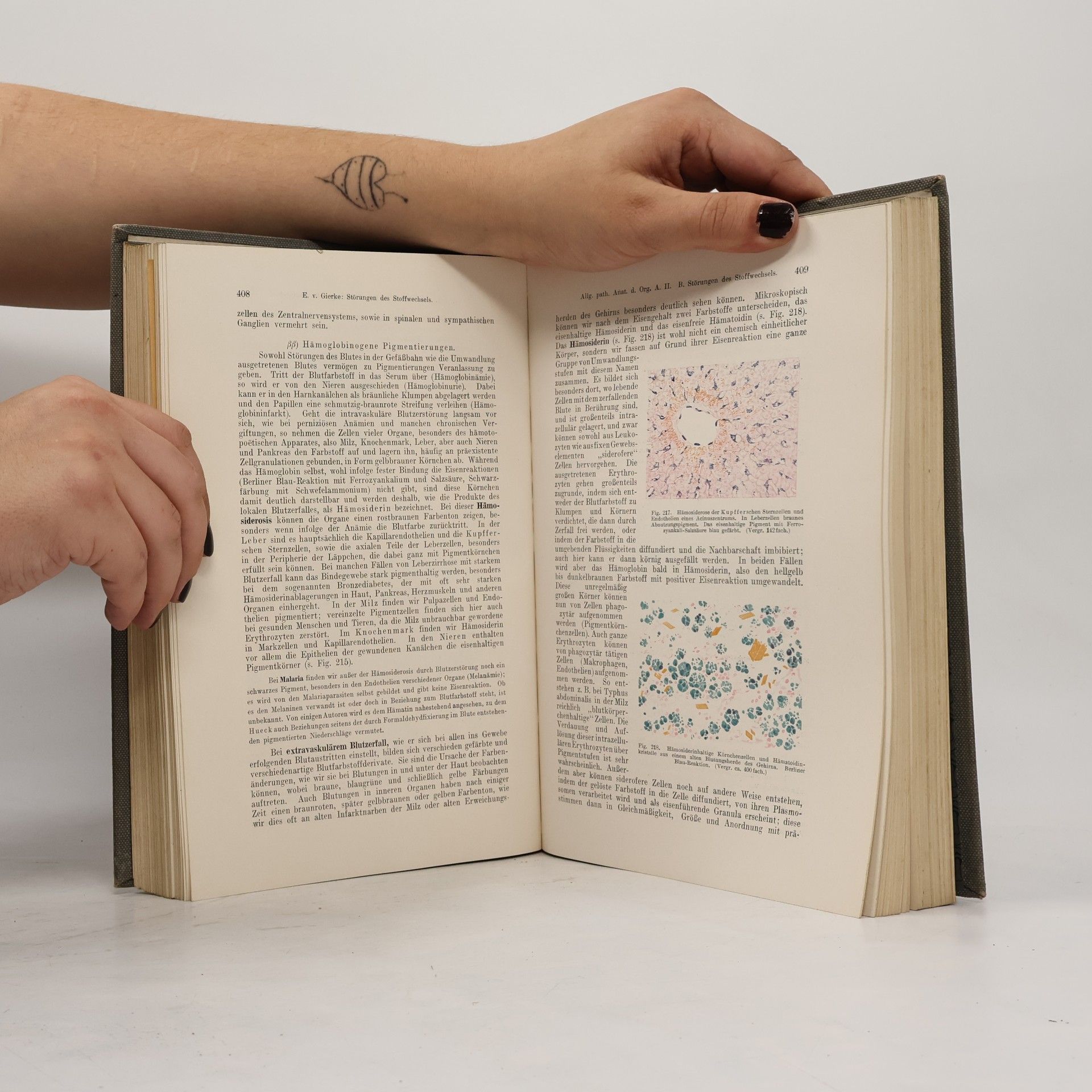 Carl Ernest Bock Patholog Anatomie
