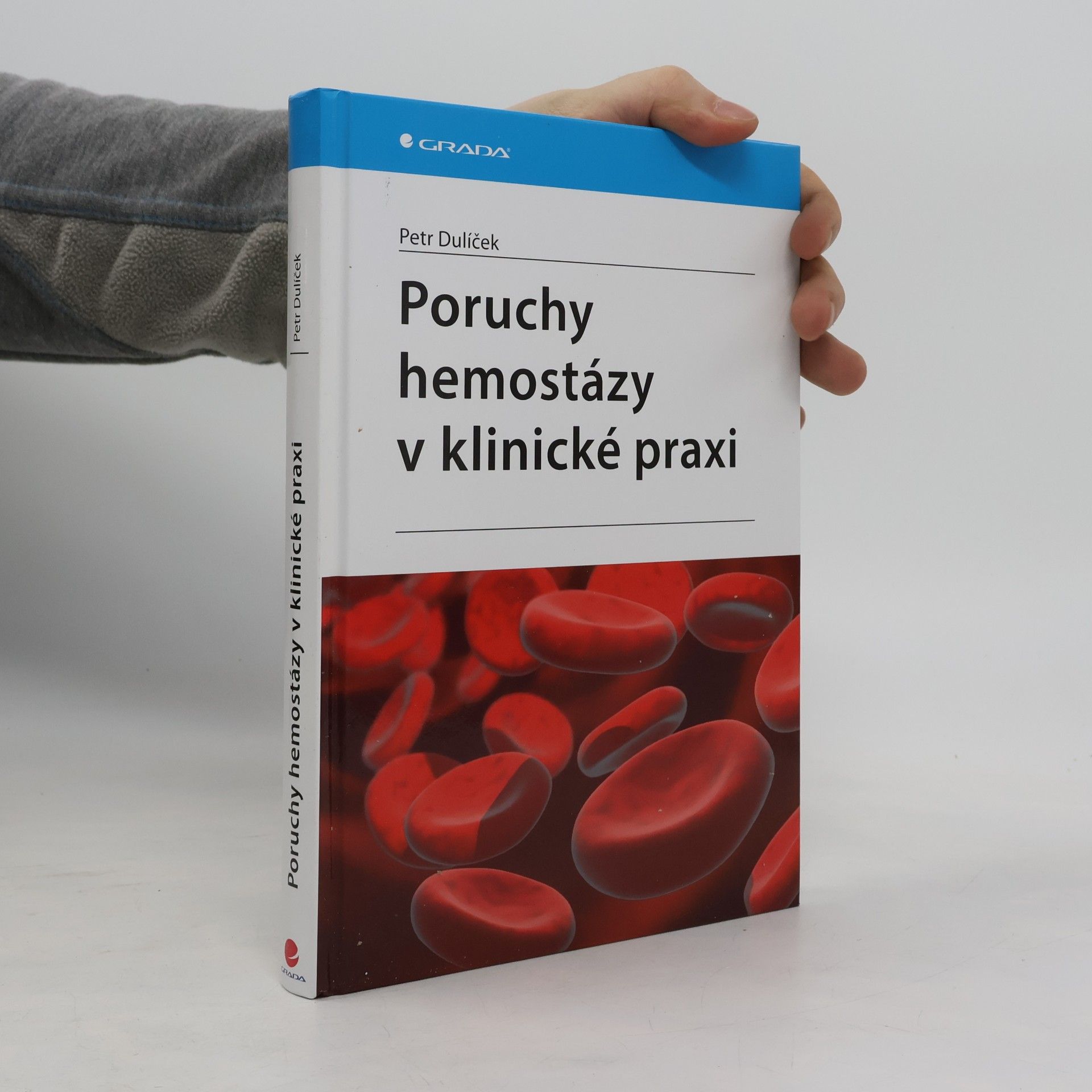 Poruchy hemostázy v klinické praxi