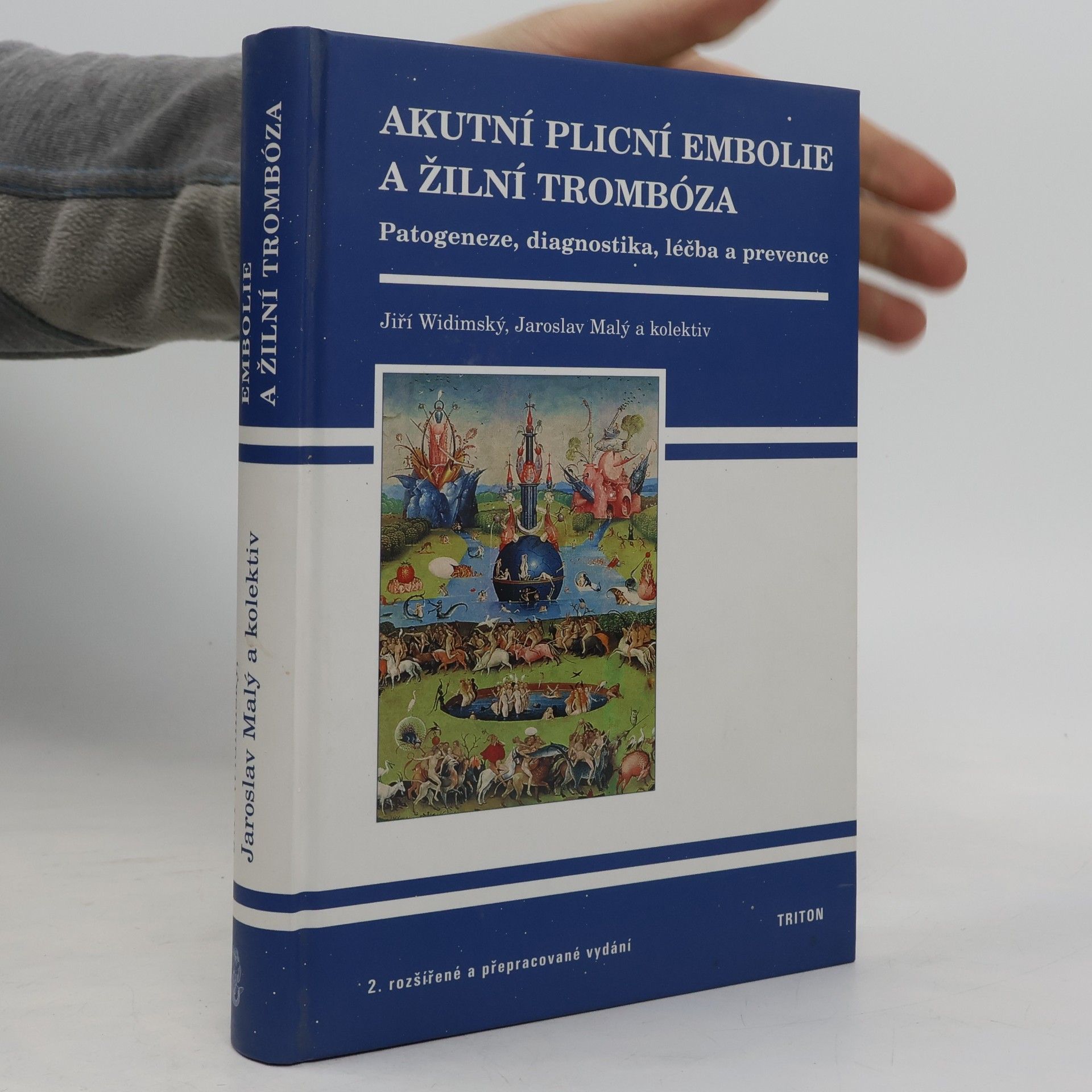 Akutní plicní embolie a žilní trombóza: patogeneze, diagnostika, léčba a prevence