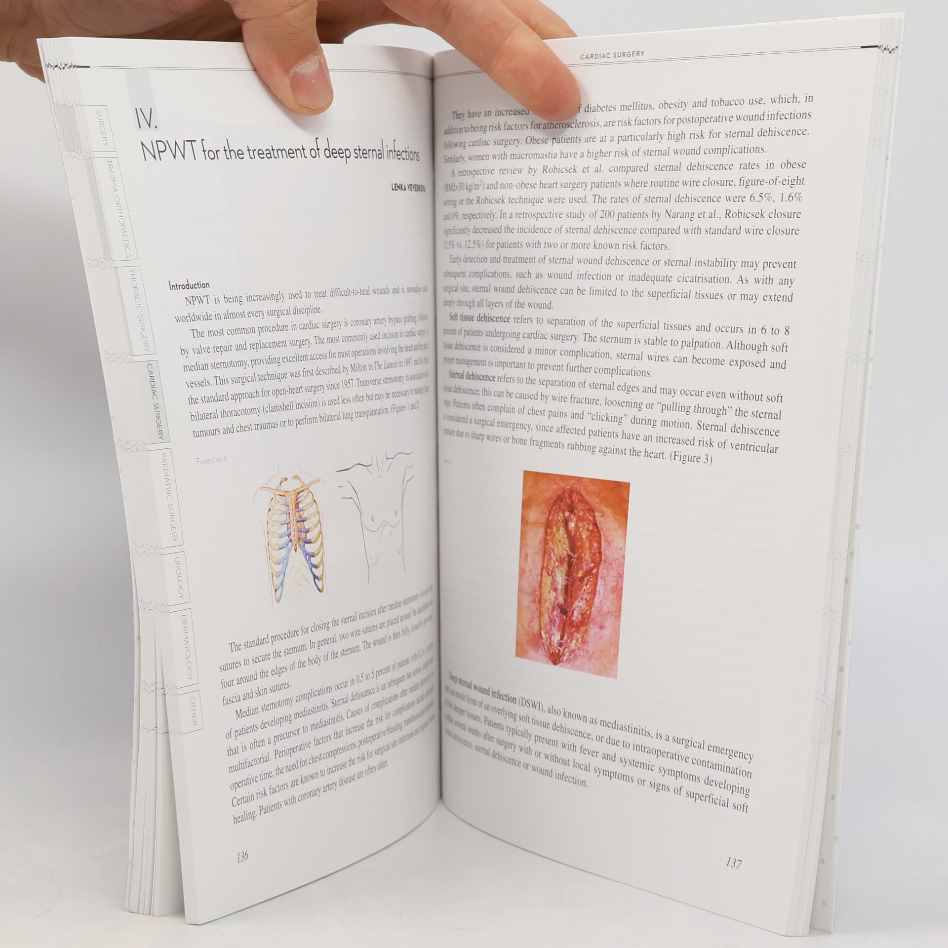 Zsolt Szentkereszty NPWT: Negative Pressure Wound Therapy (Scientific Monograph)
