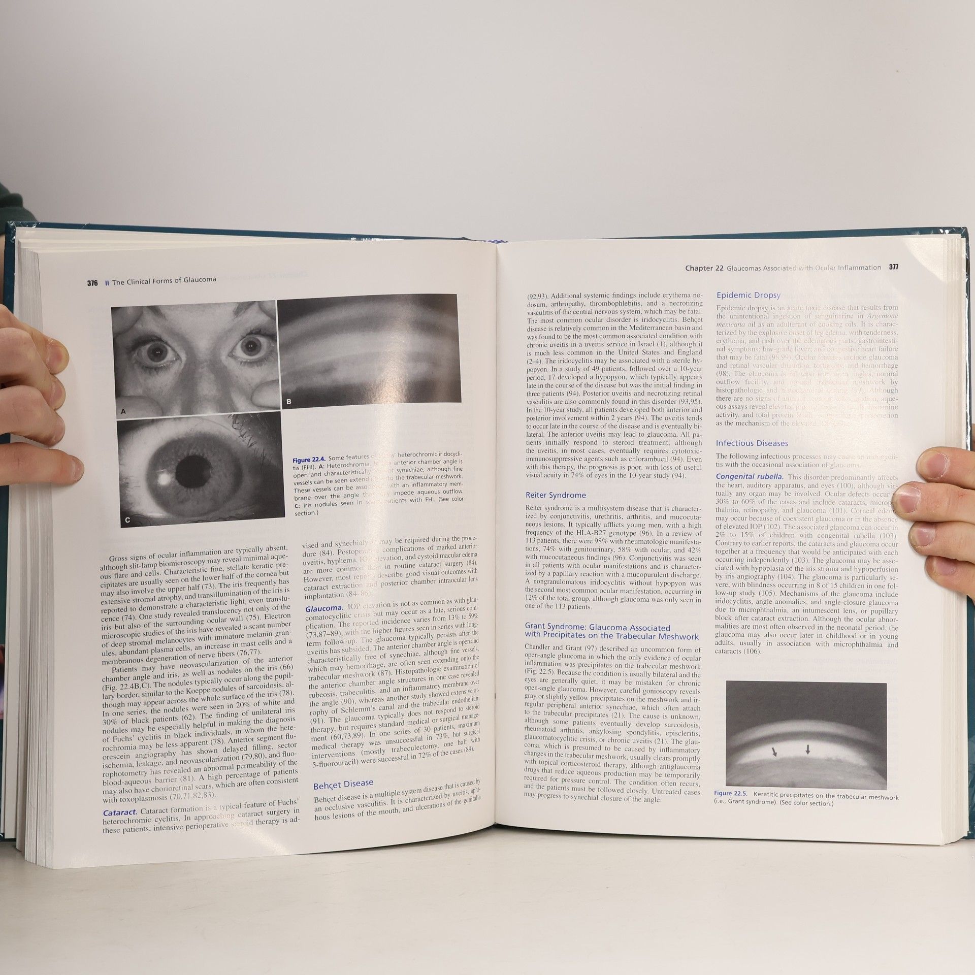 R. Rand Allingham Shields' Textbook of Glaucoma